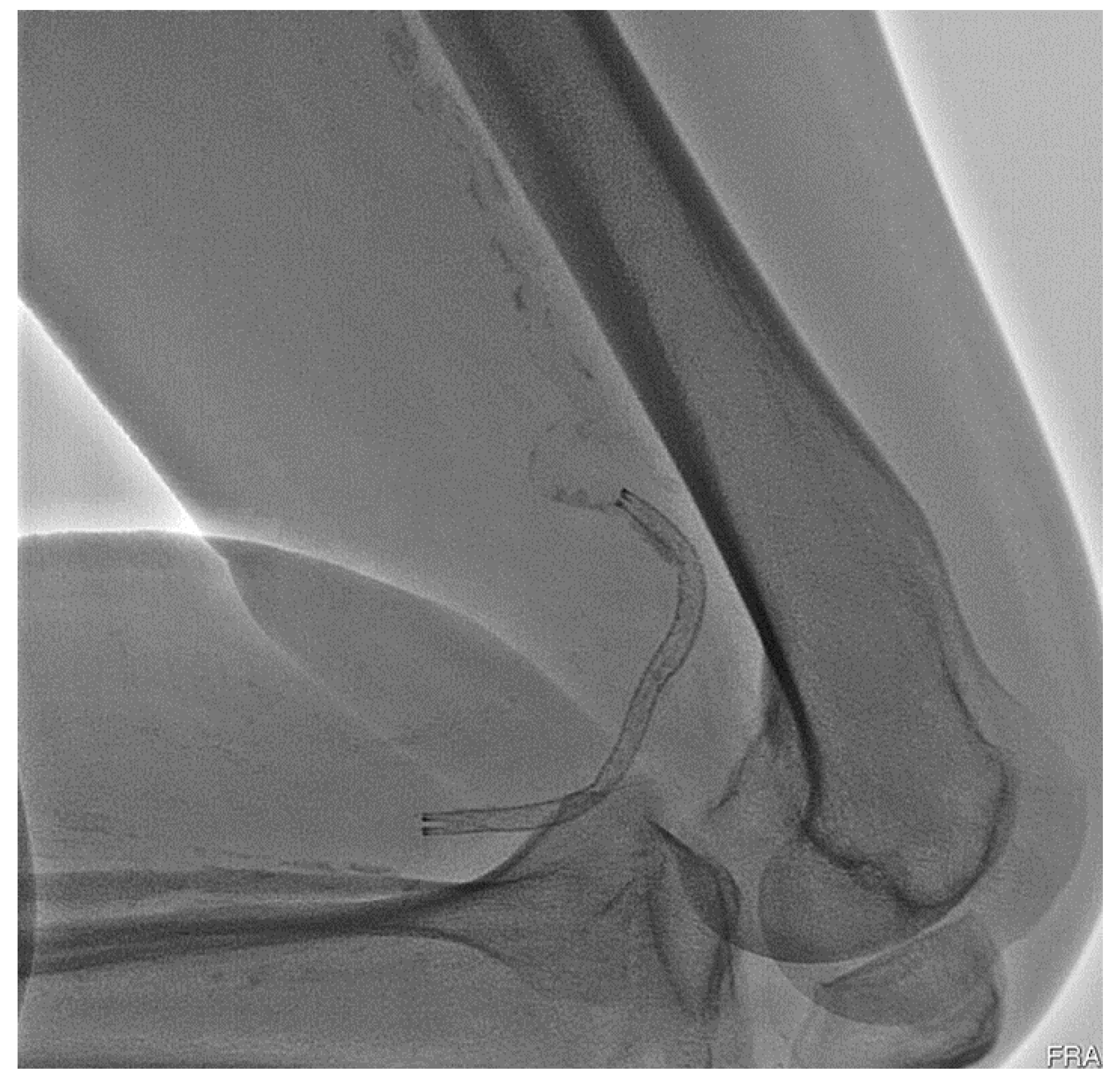 Bioengineering 10 00443 g001 Bioengineering 10 00443 g001