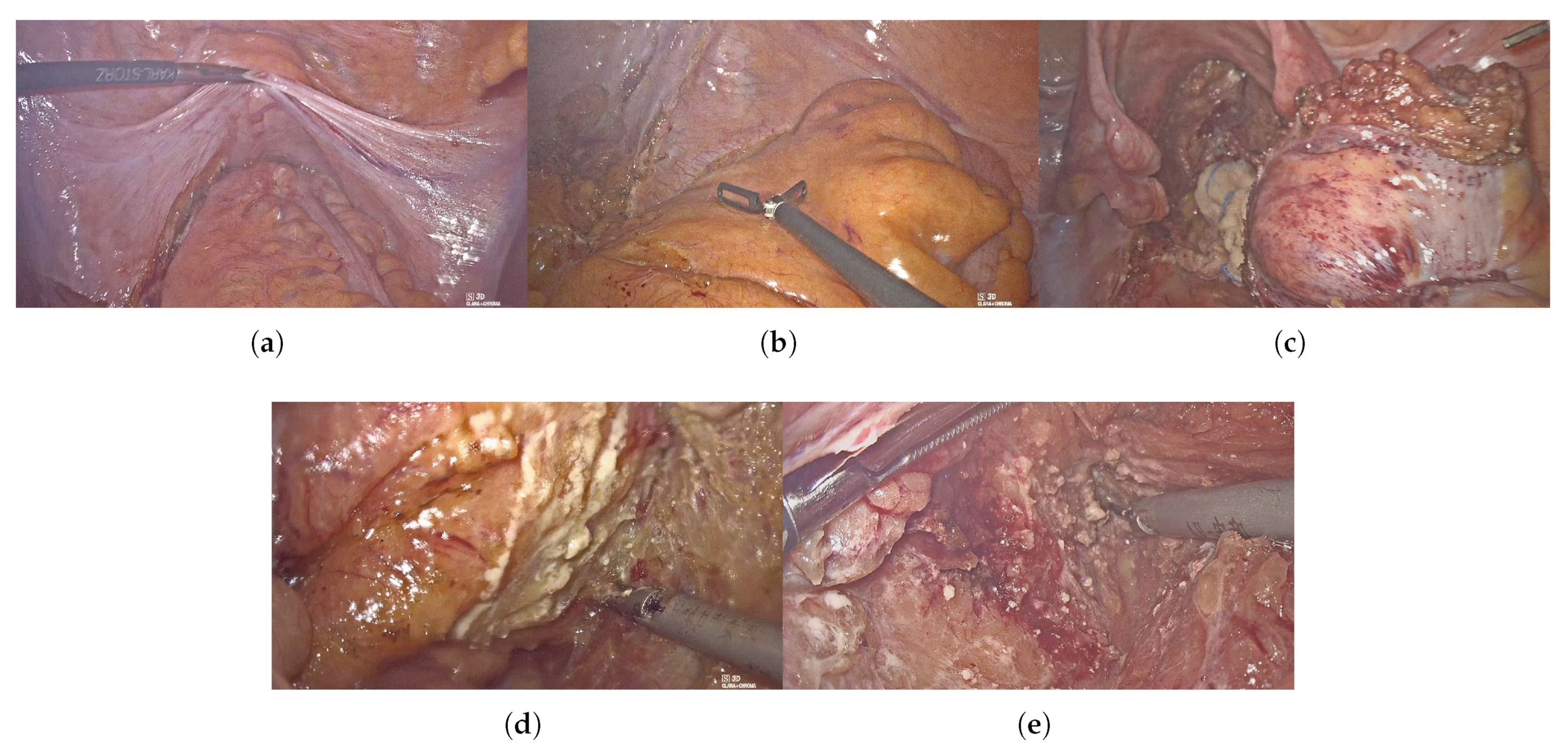 Bioengineering 10 00468 g002