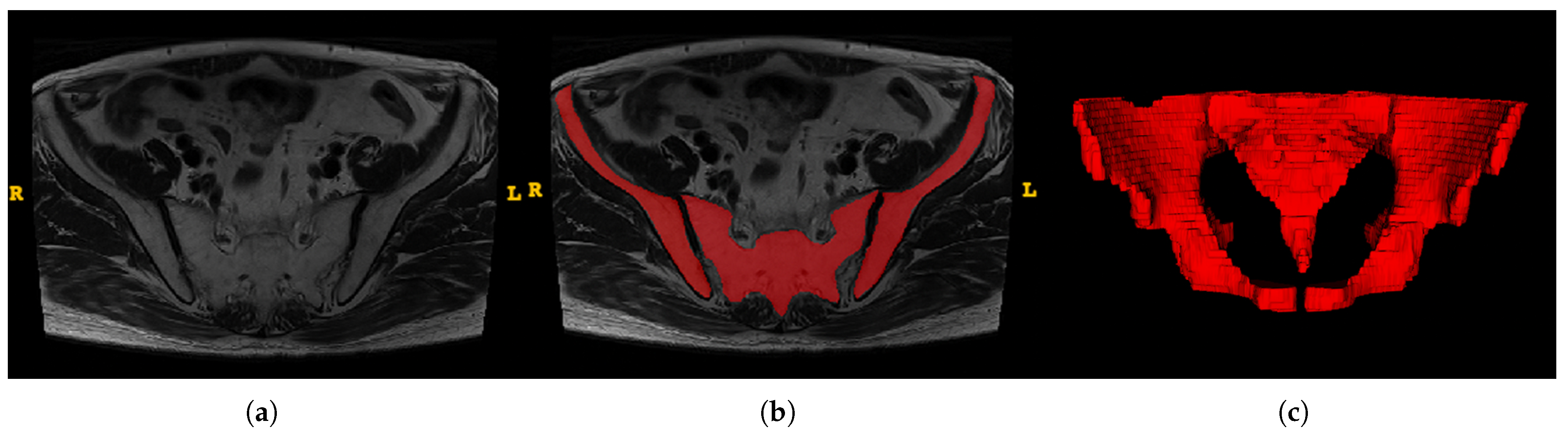 Bioengineering 10 00468 g003
