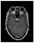 Bioengineering 10 00475 i004