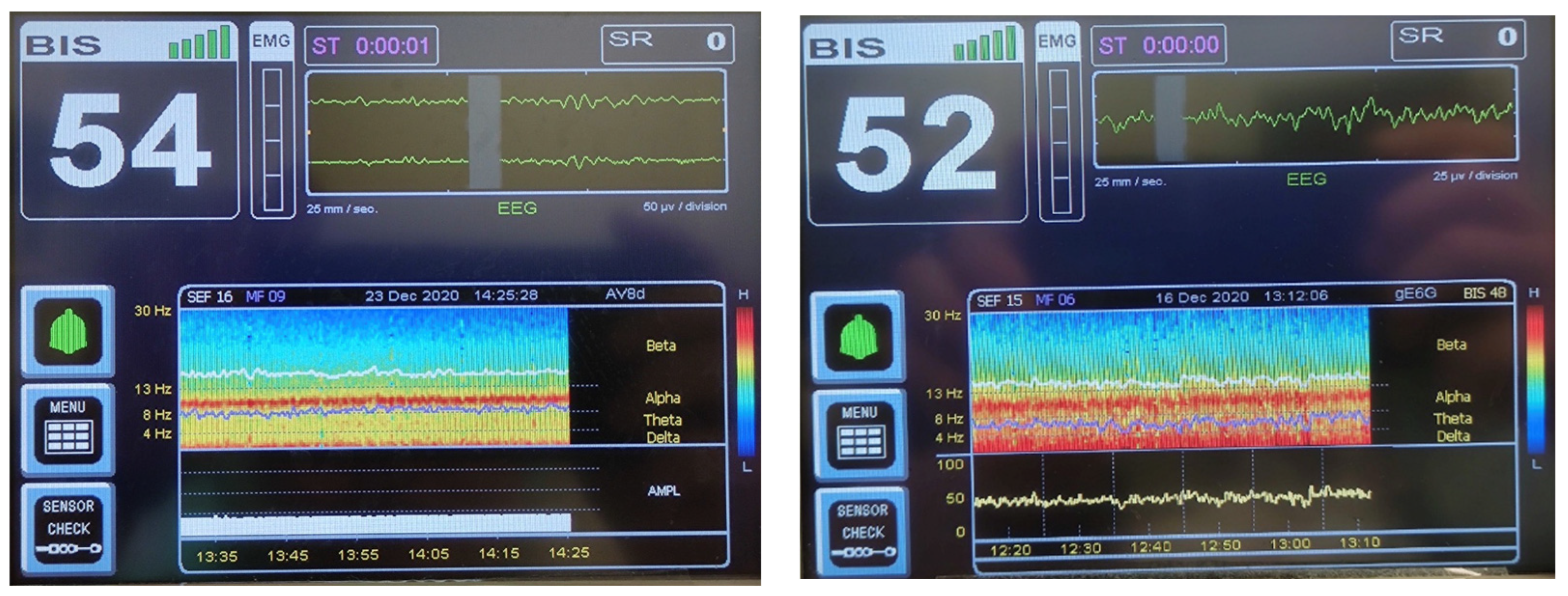 Bioengineering 10 00494 g002 Bioengineering 10 00494 g002