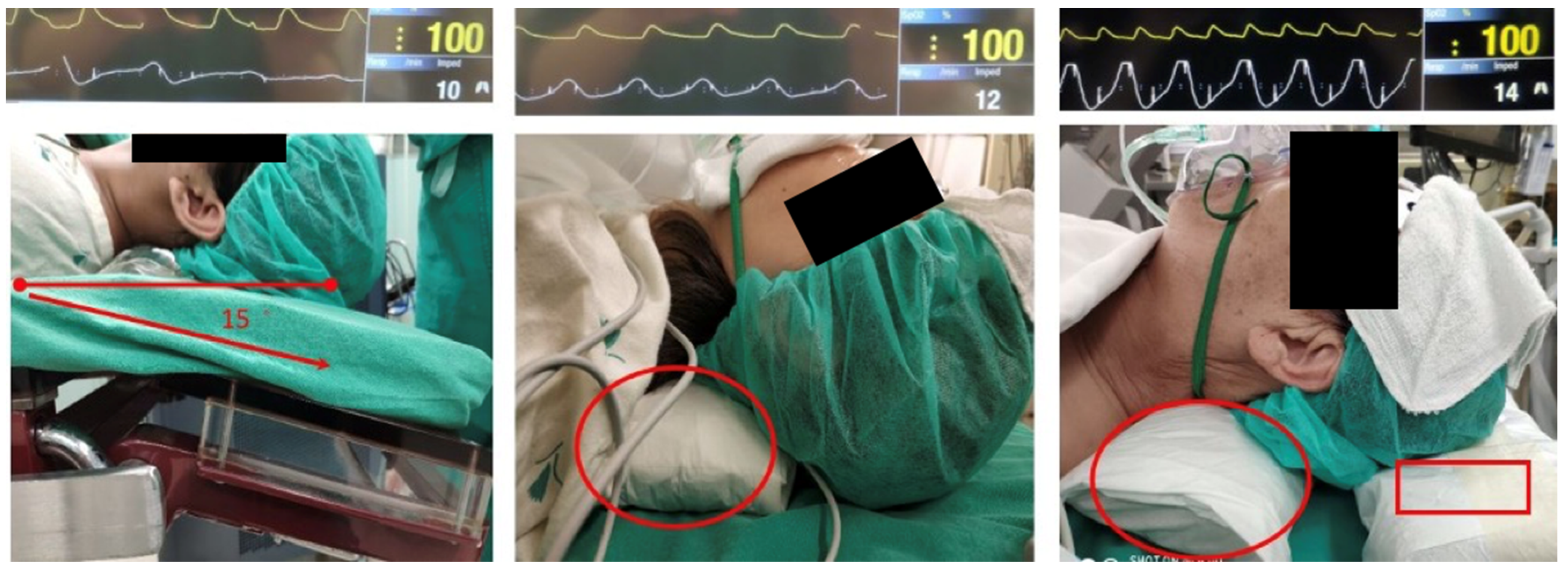 Bioengineering 10 00494 g003 Bioengineering 10 00494 g003