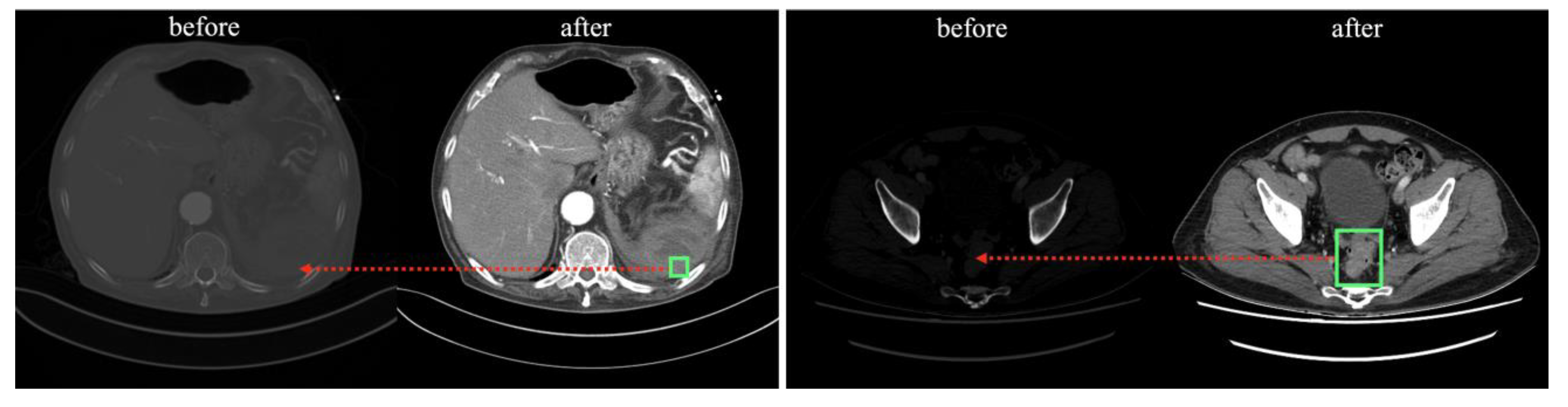 Bioengineering 10 00502 g002 Bioengineering 10 00502 g002