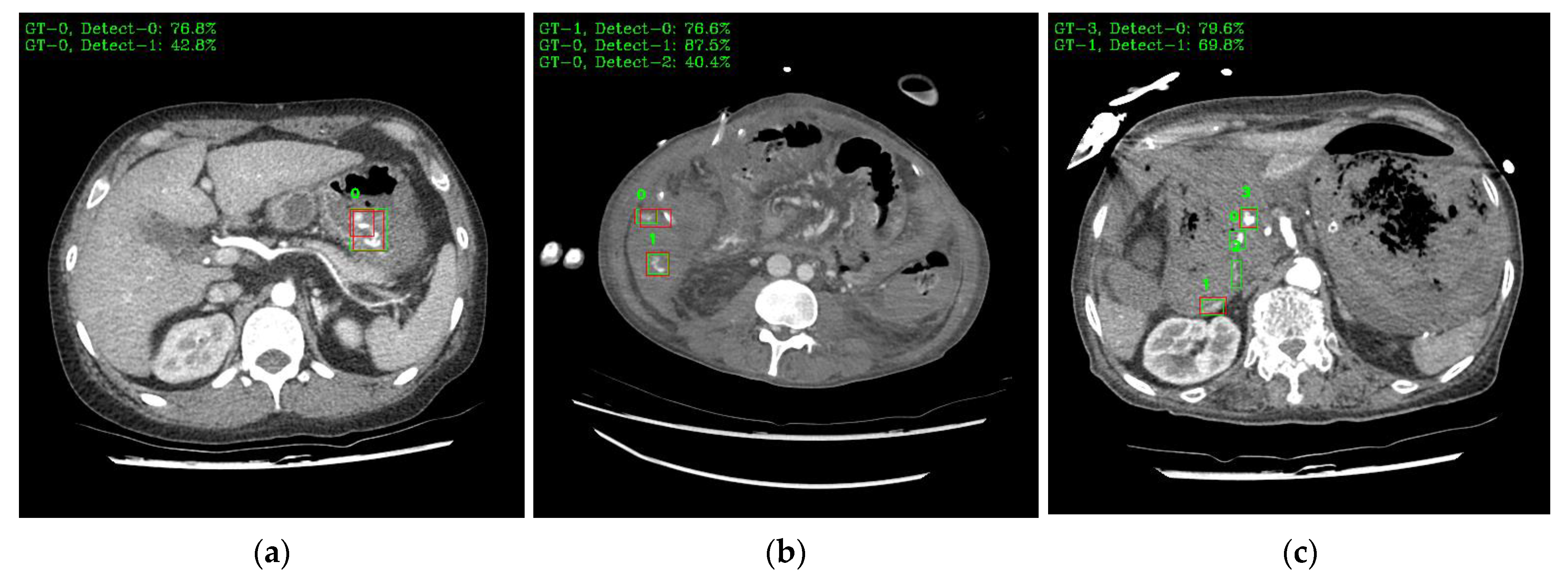 Bioengineering 10 00502 g009a Bioengineering 10 00502 g009a
