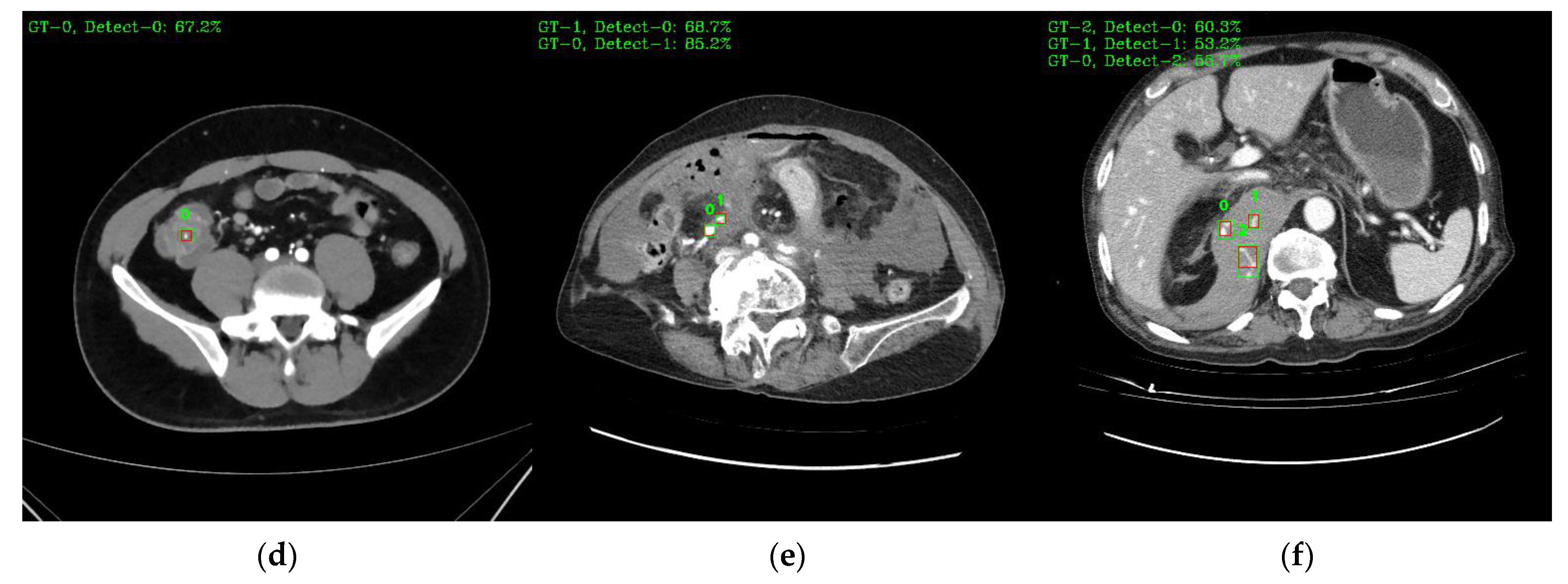 Bioengineering 10 00502 g009b Bioengineering 10 00502 g009b