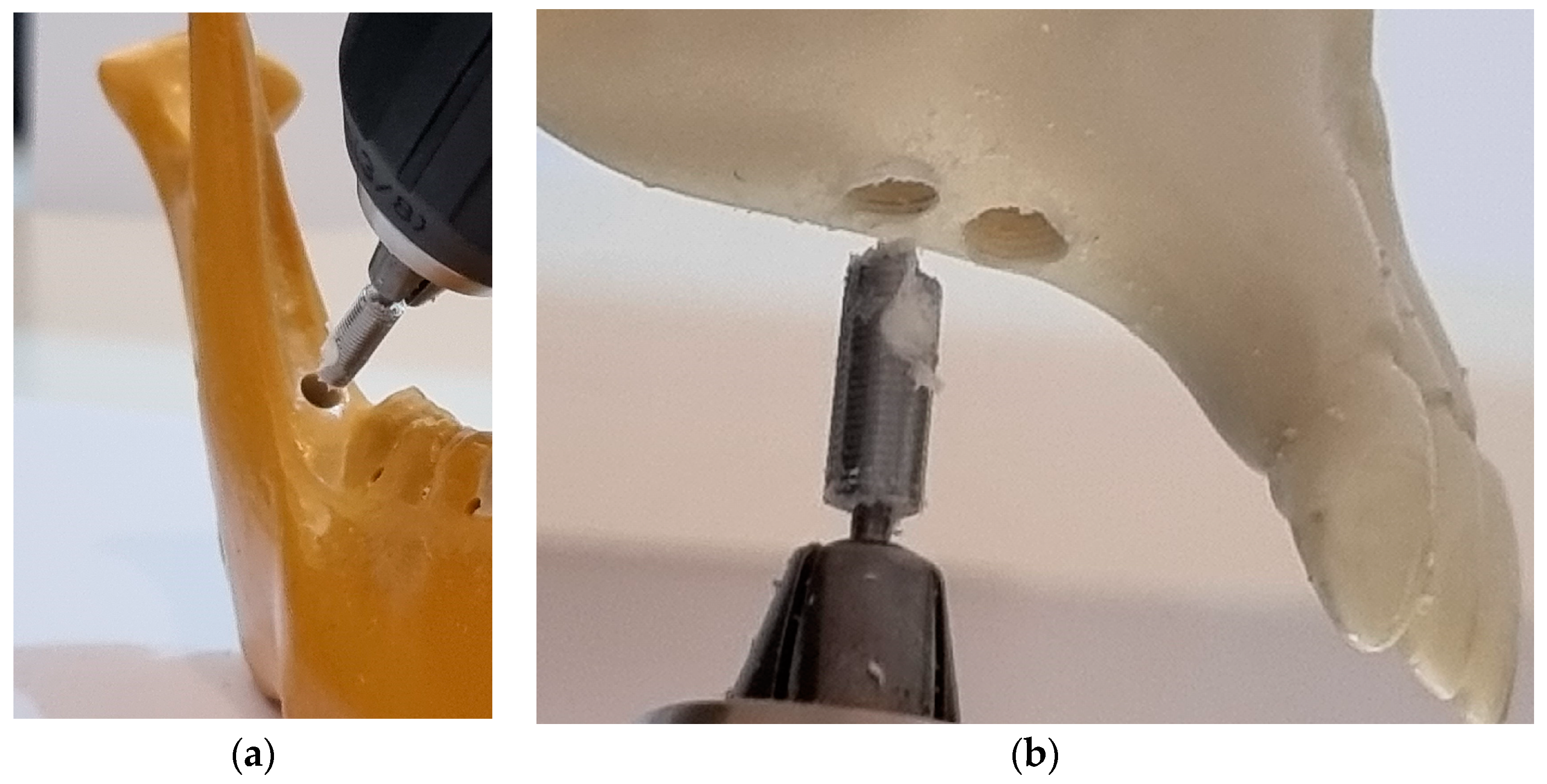 Bioengineering 10 00505 g006