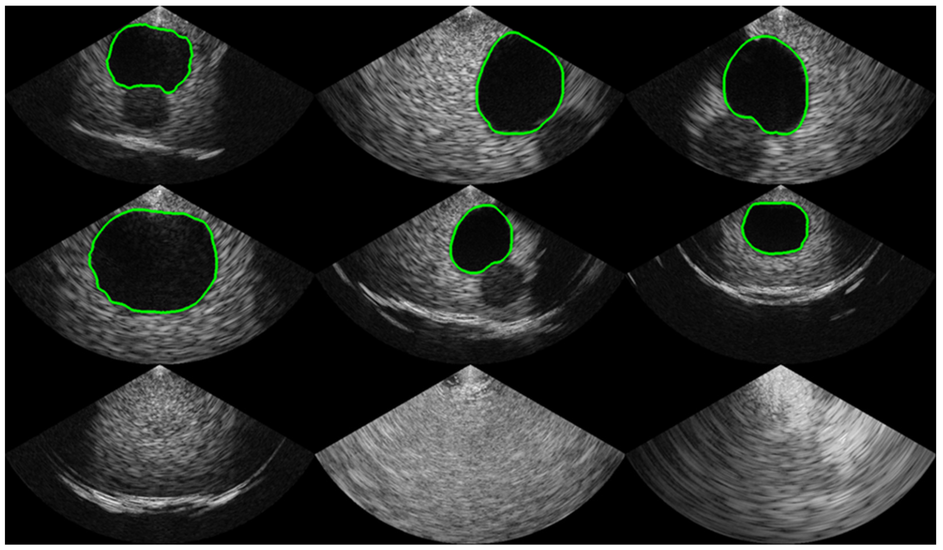 Bioengineering 10 00525 g002 Bioengineering 10 00525 g002