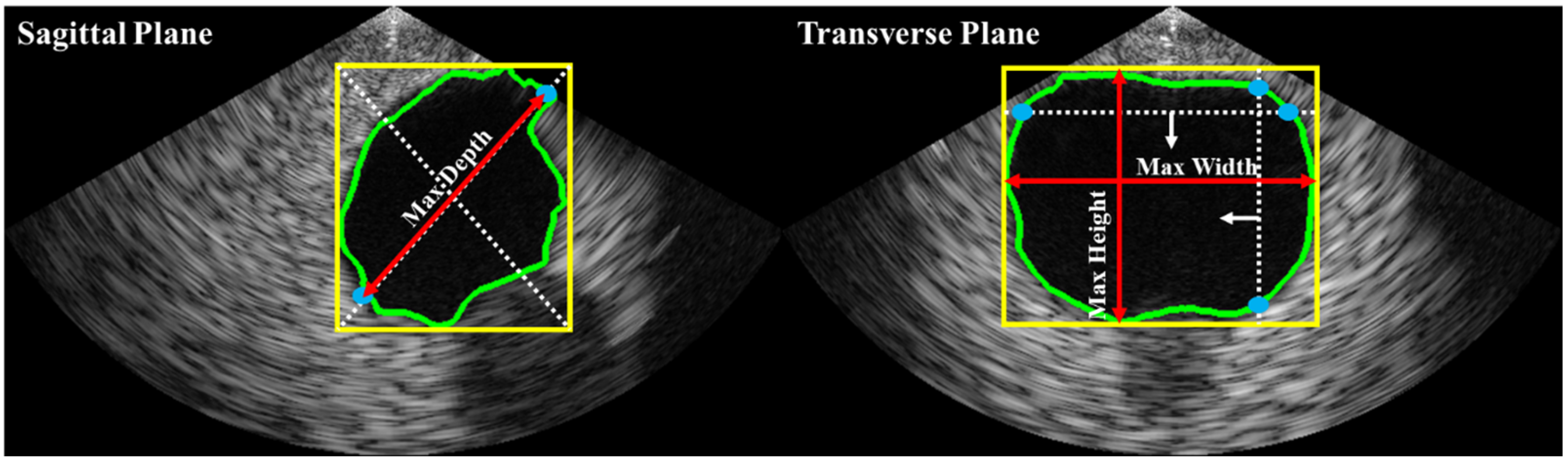 Bioengineering 10 00525 g004 Bioengineering 10 00525 g004