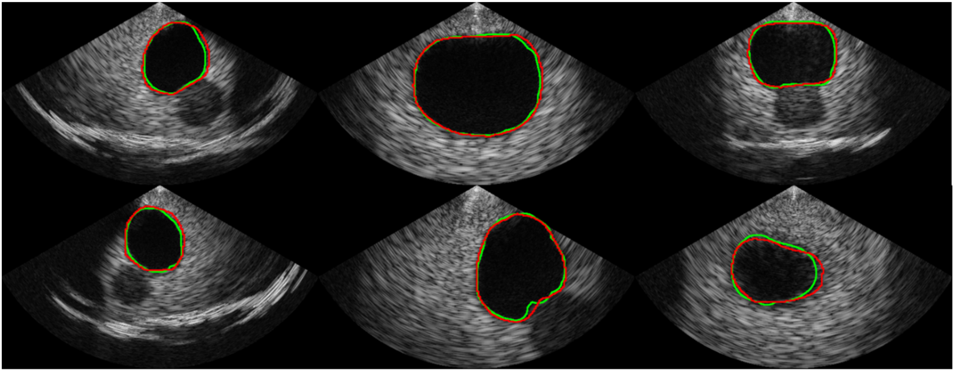 Bioengineering 10 00525 g006 Bioengineering 10 00525 g006