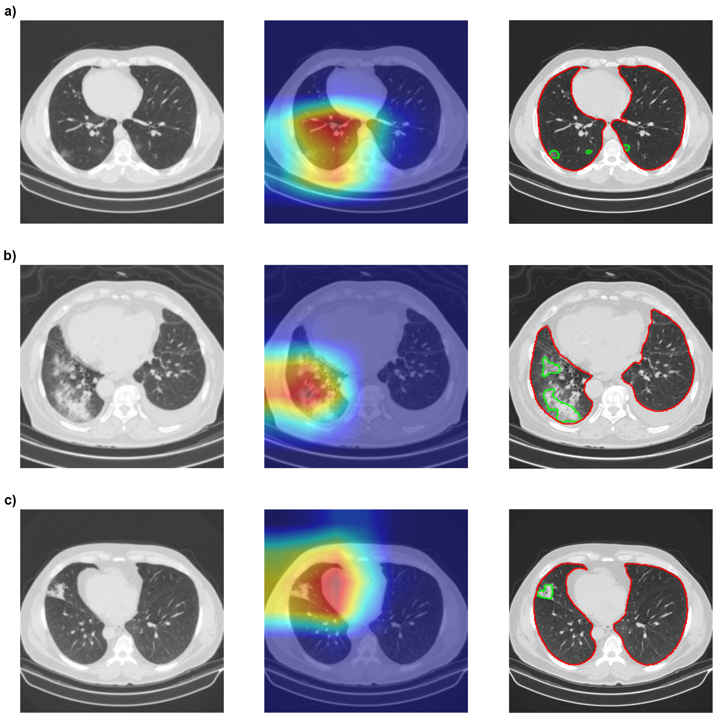 Bioengineering 10 00529 g009