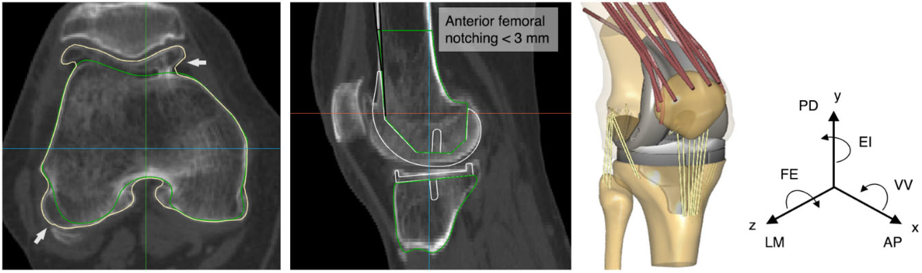 Bioengineering 10 00543 g001