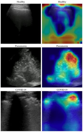 Bioengineering 10 00555 g003