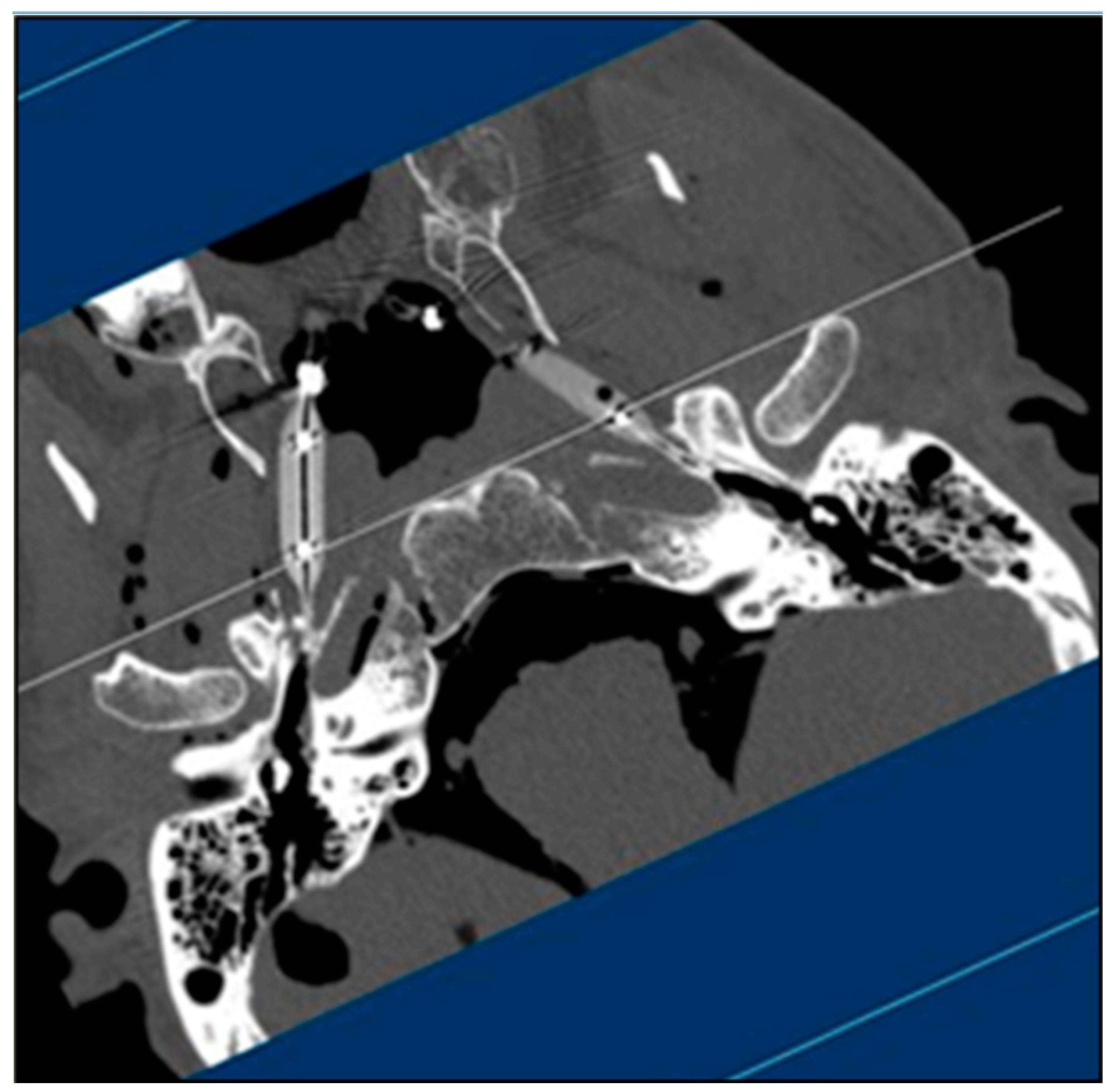 Bioengineering 10 00592 g002