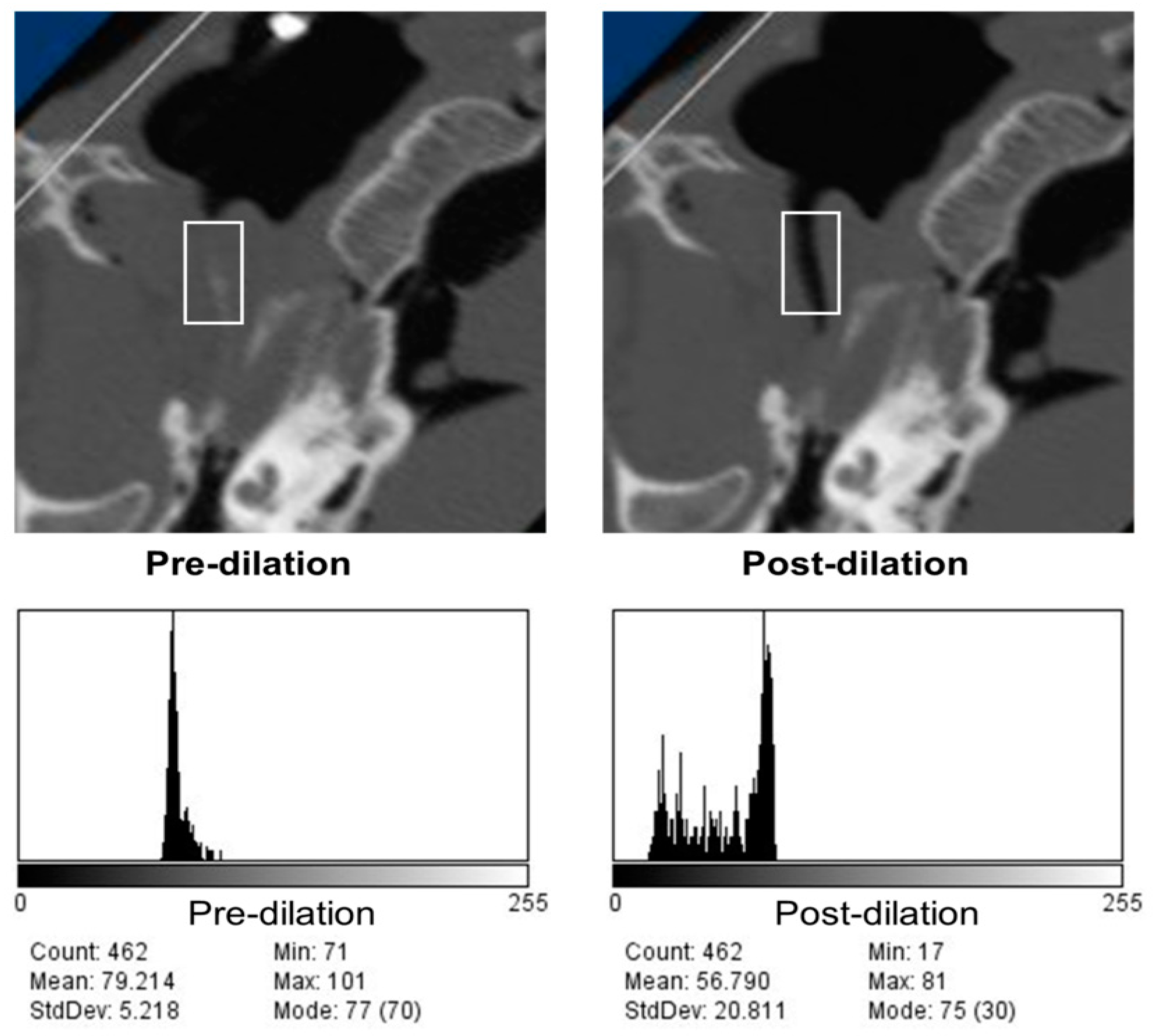Bioengineering 10 00592 g004