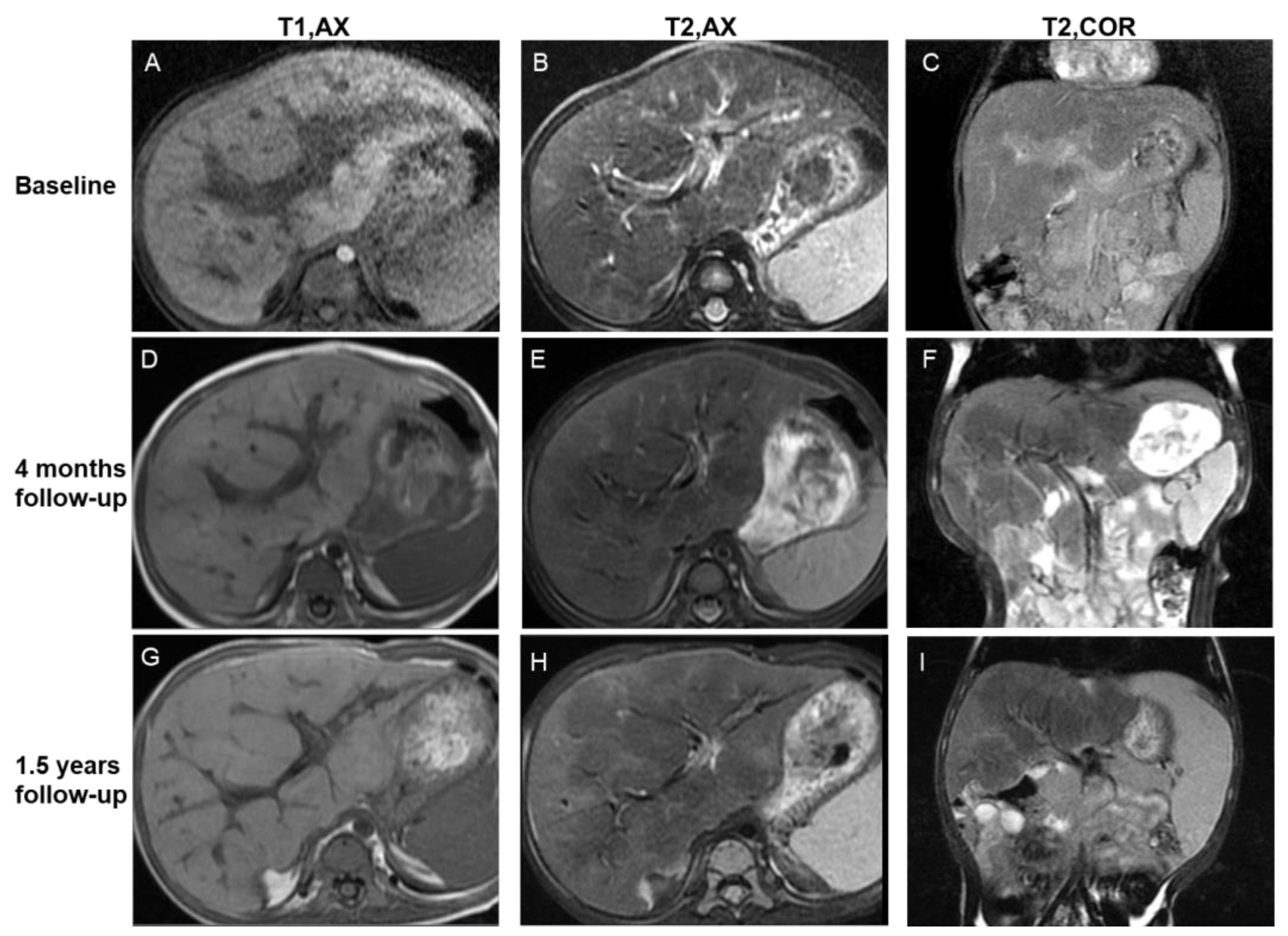 Bioengineering 10 00598 g004