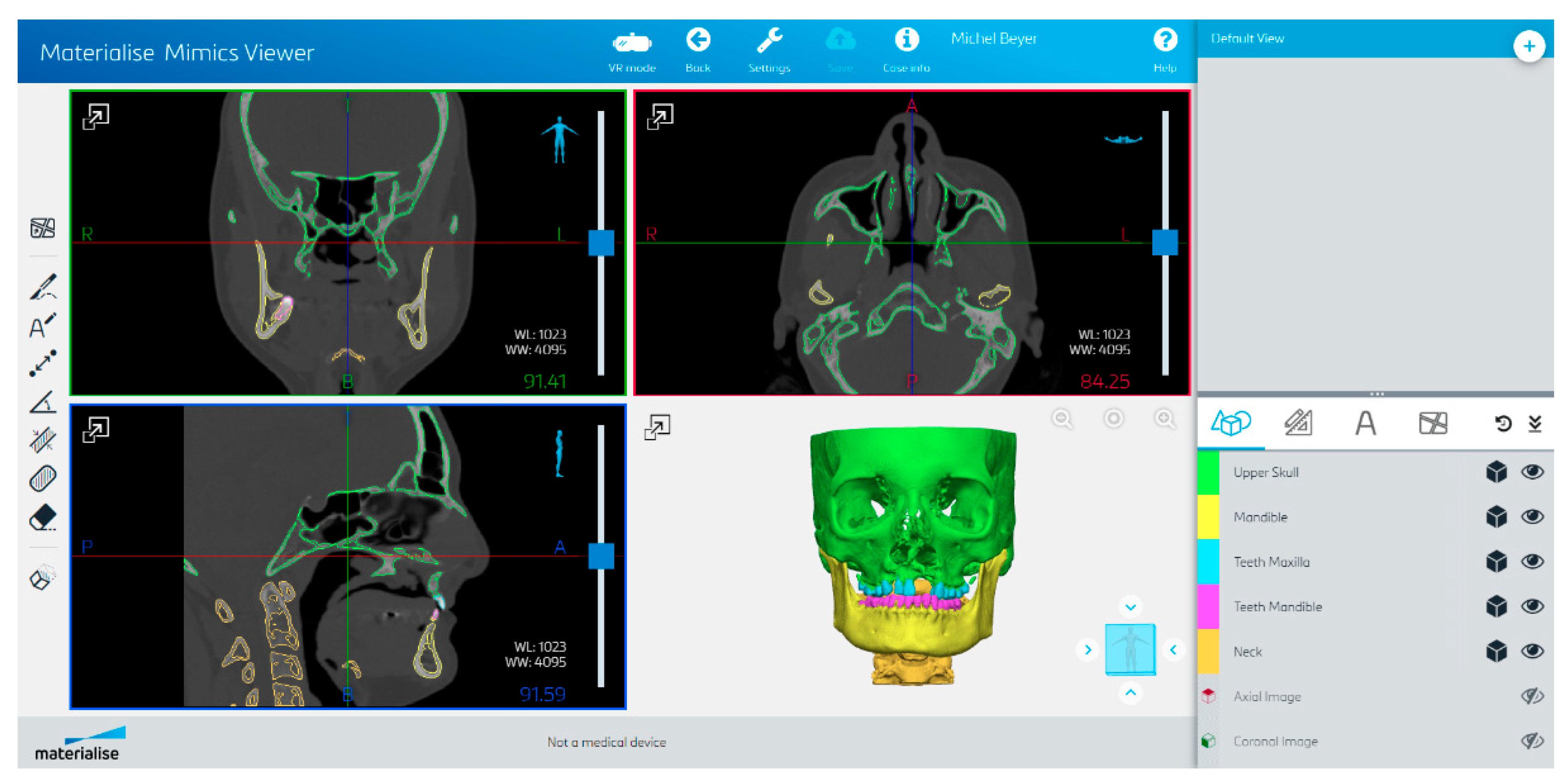 Bioengineering 10 00604 g005