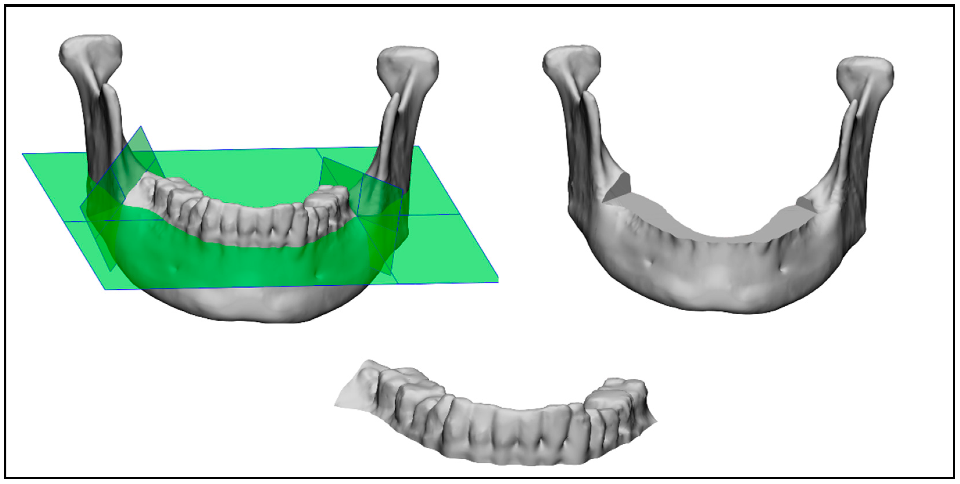 Bioengineering 10 00604 g008