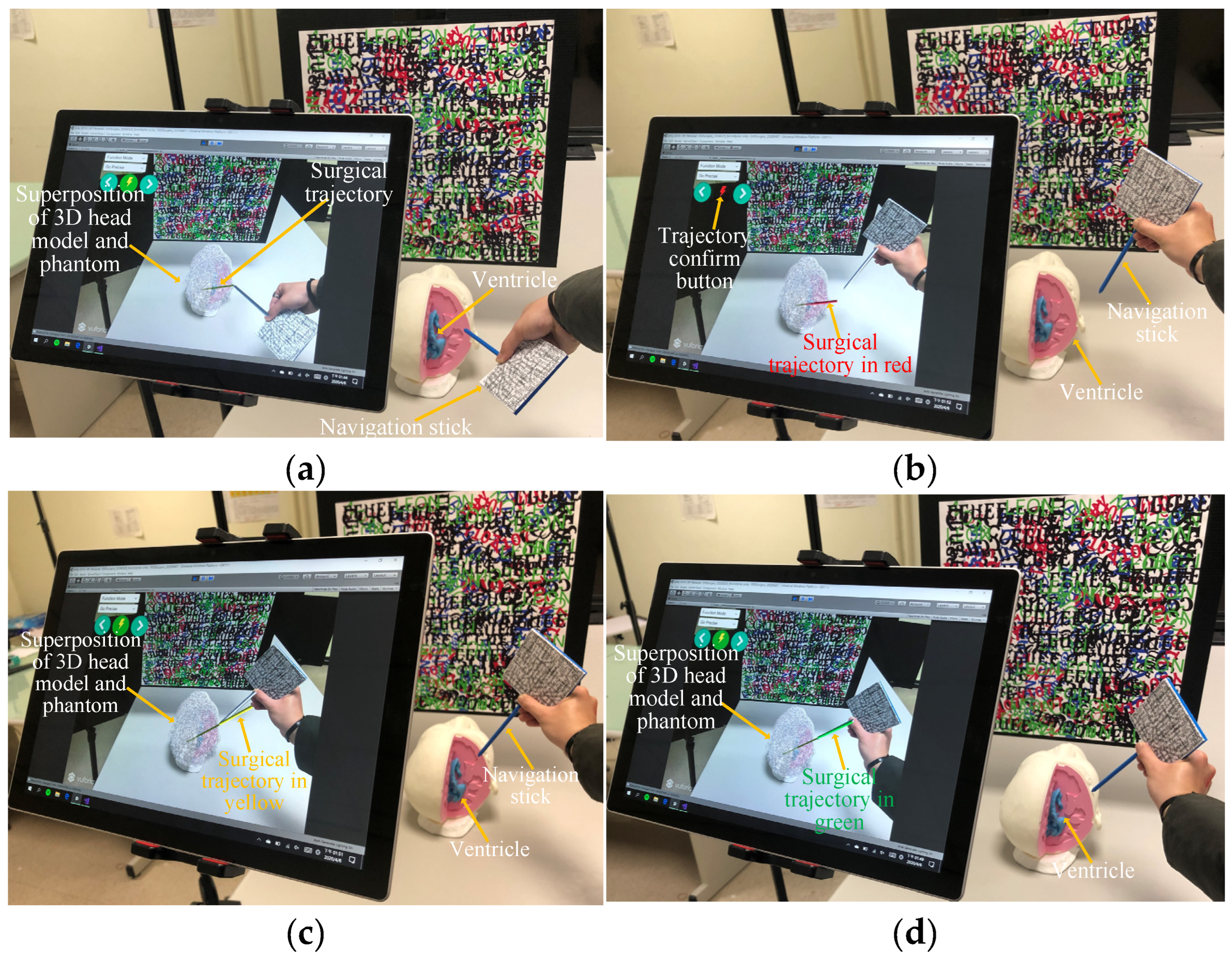 Bioengineering 10 00617 g003