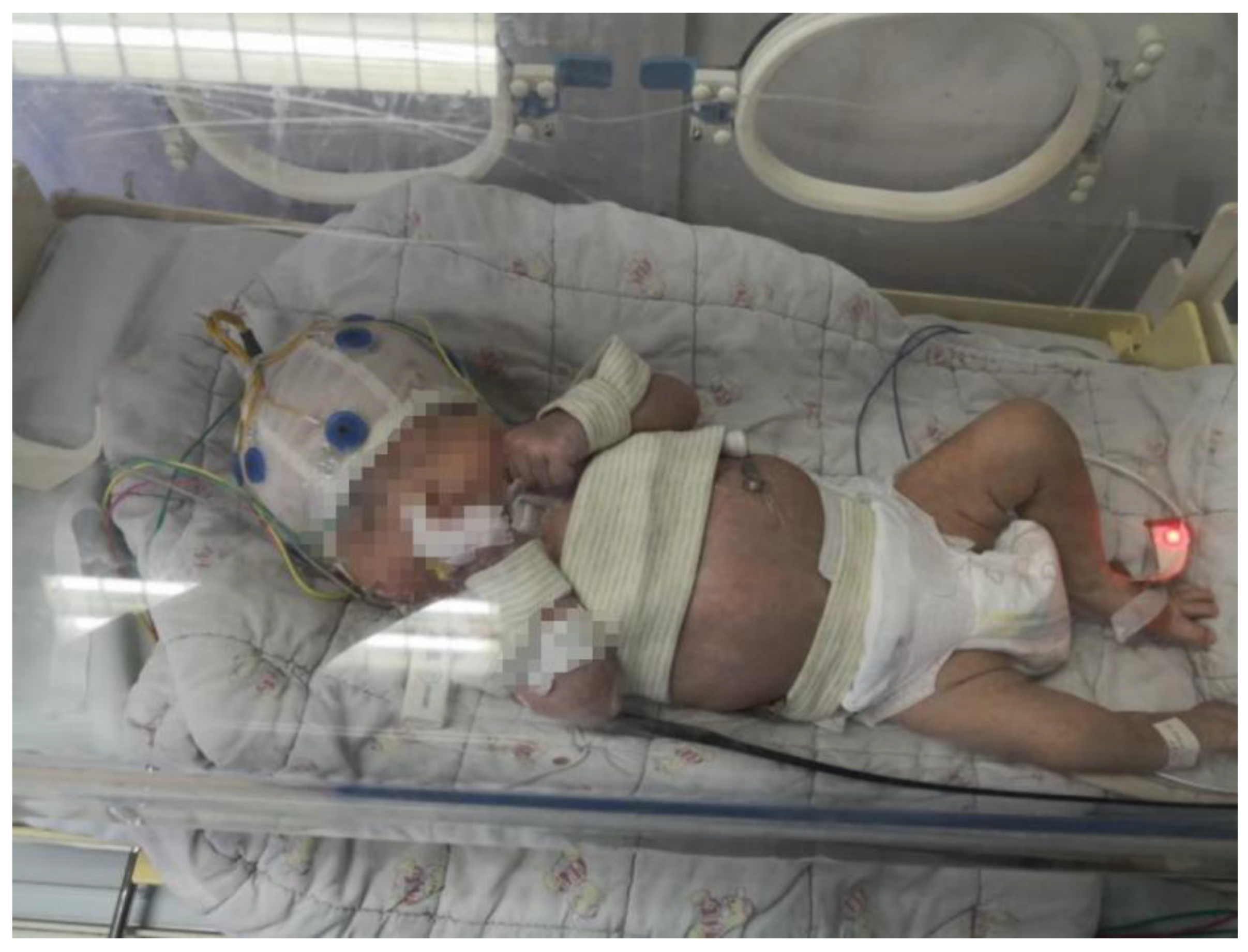 Bioengineering 10 00658 g003 Bioengineering 10 00658 g003