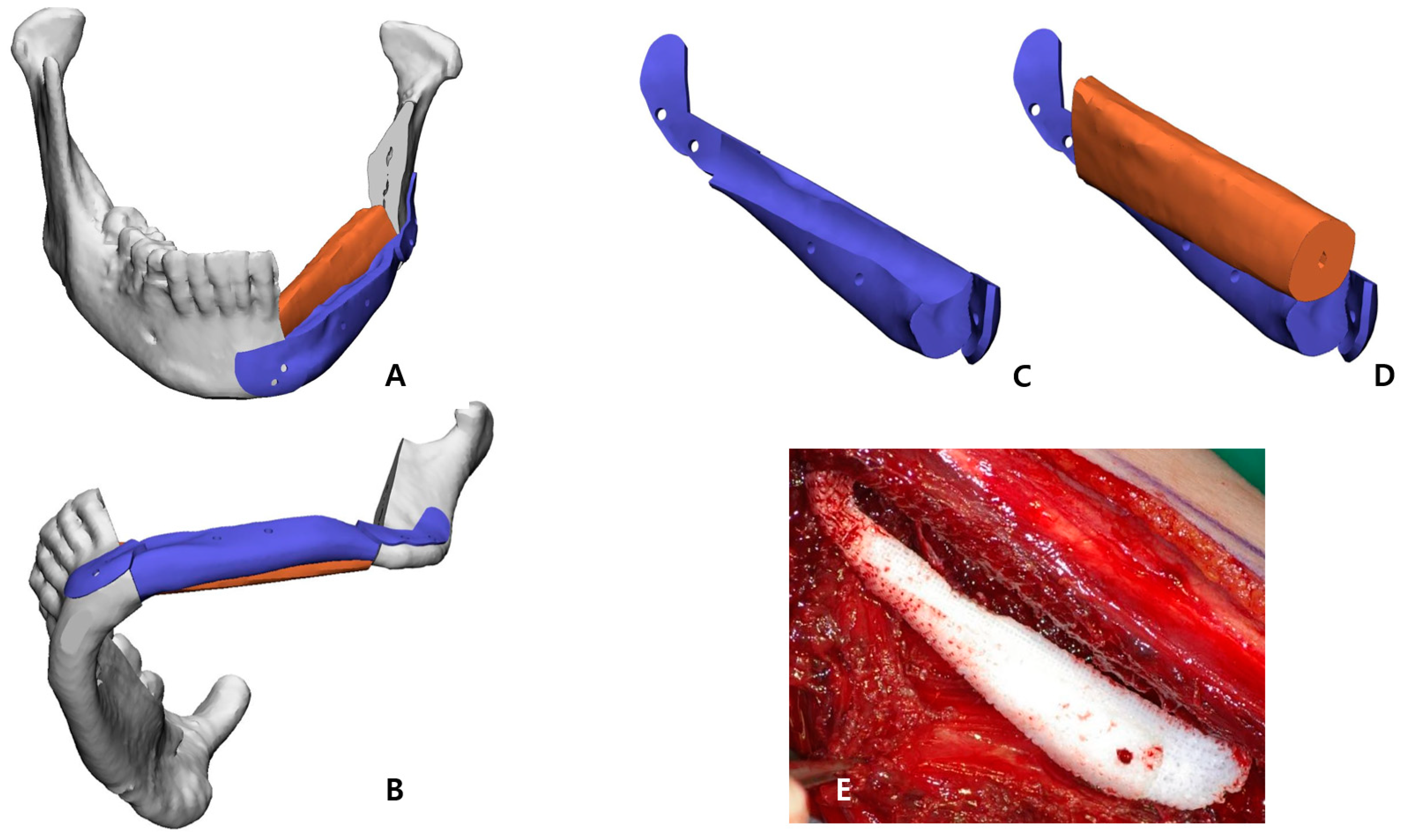 Bioengineering 10 00684 g003