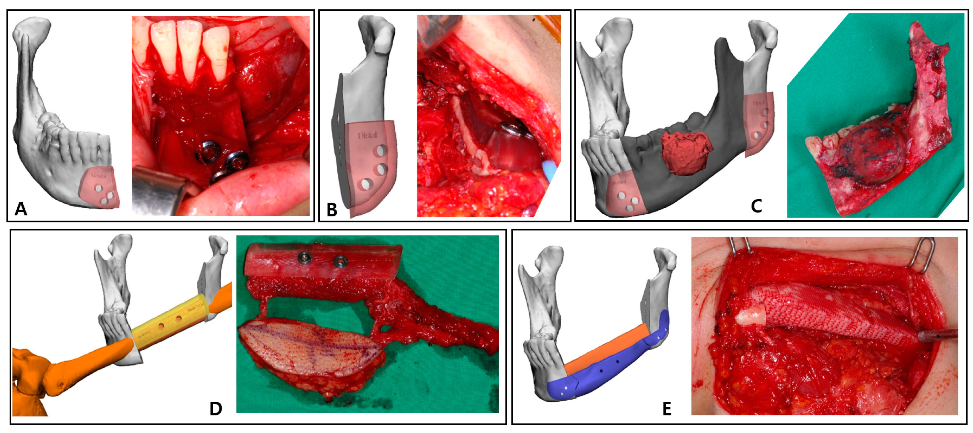 Bioengineering 10 00684 g004