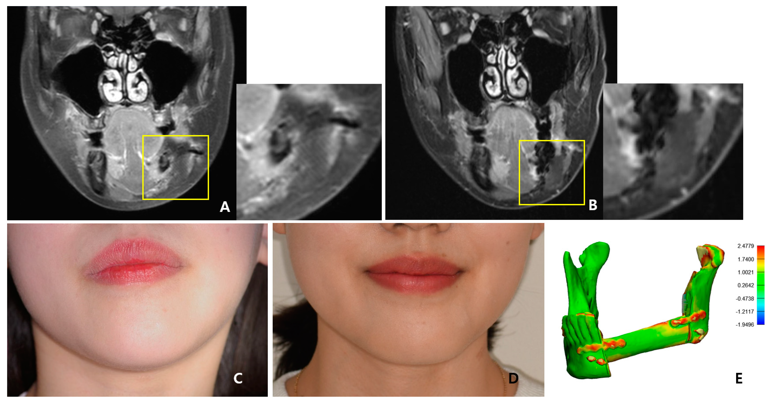 Bioengineering 10 00684 g007a
