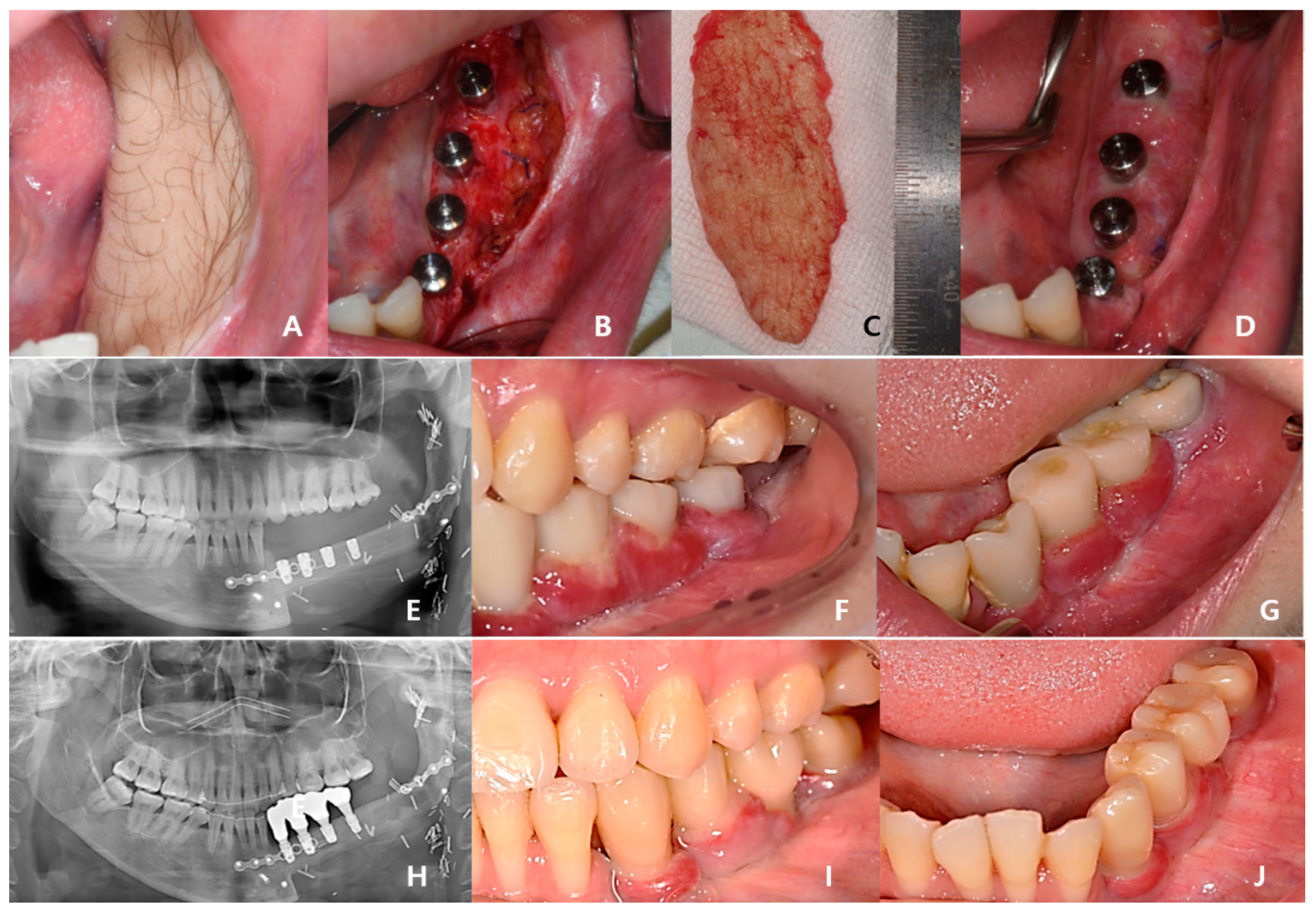 Bioengineering 10 00684 g008