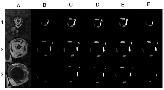 Bioengineering 10 00699 g0a1