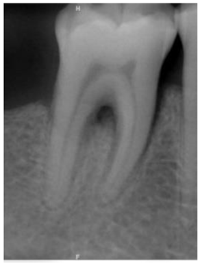 Bioengineering 10 00802 i002