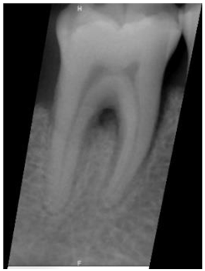 Bioengineering 10 00802 i003