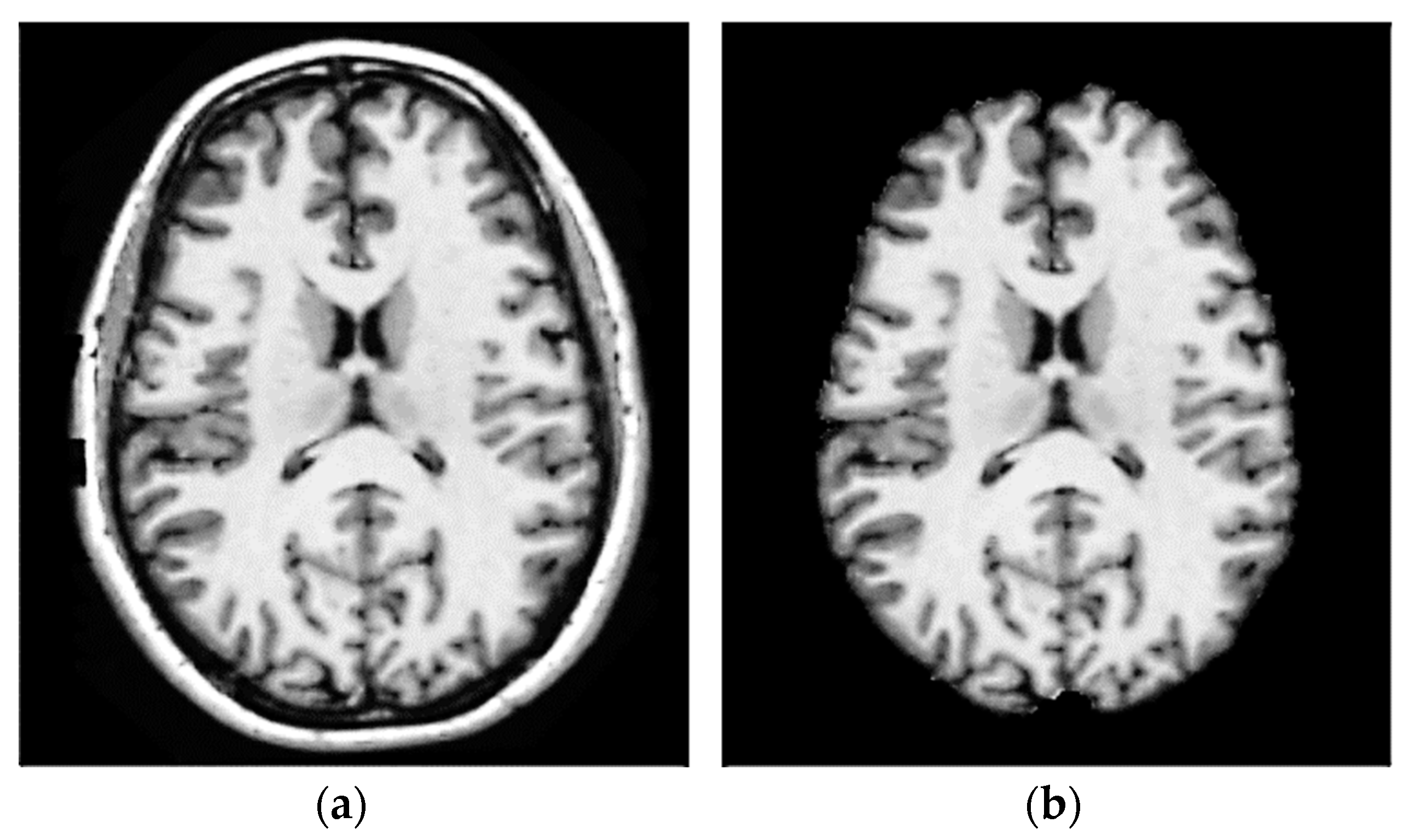 Bioengineering 10 00819 g005
