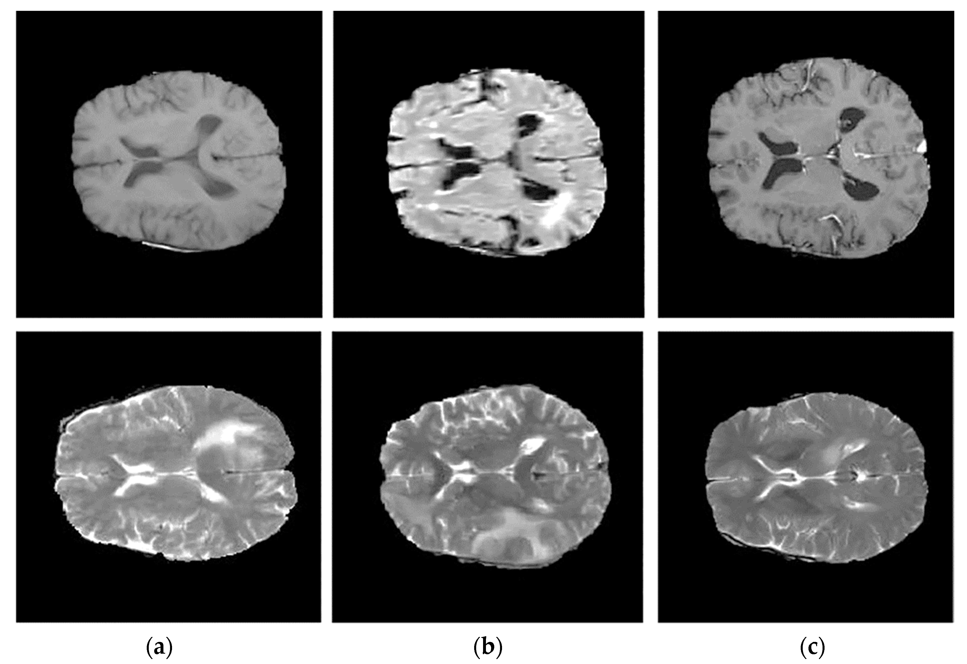 Bioengineering 10 00819 g008