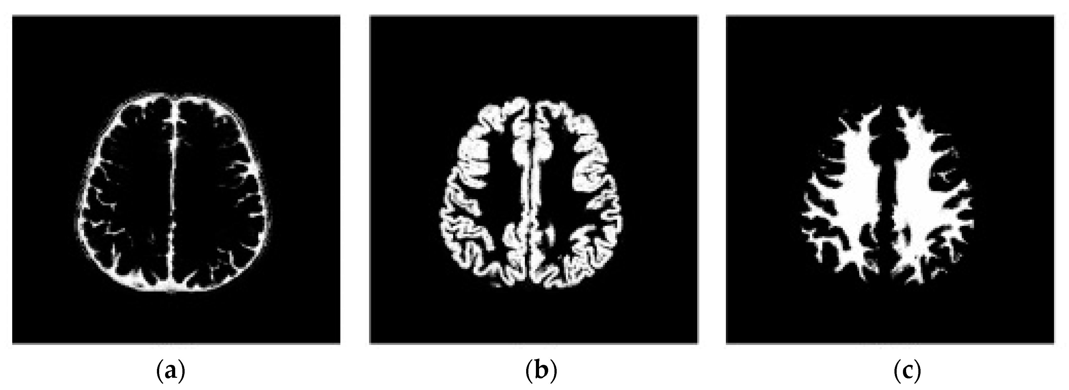 Bioengineering 10 00819 g011