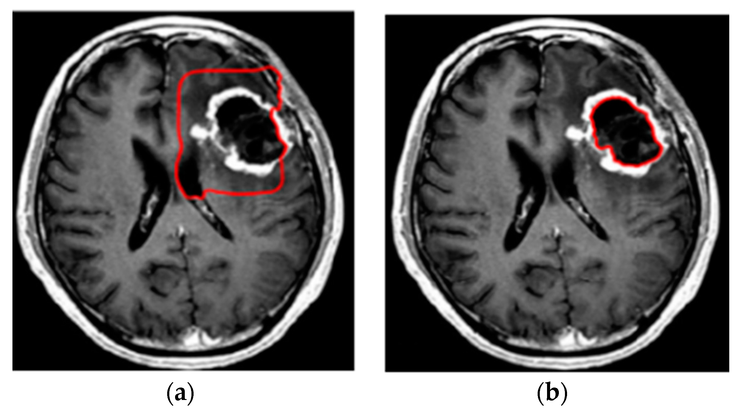 Bioengineering 10 00819 g017