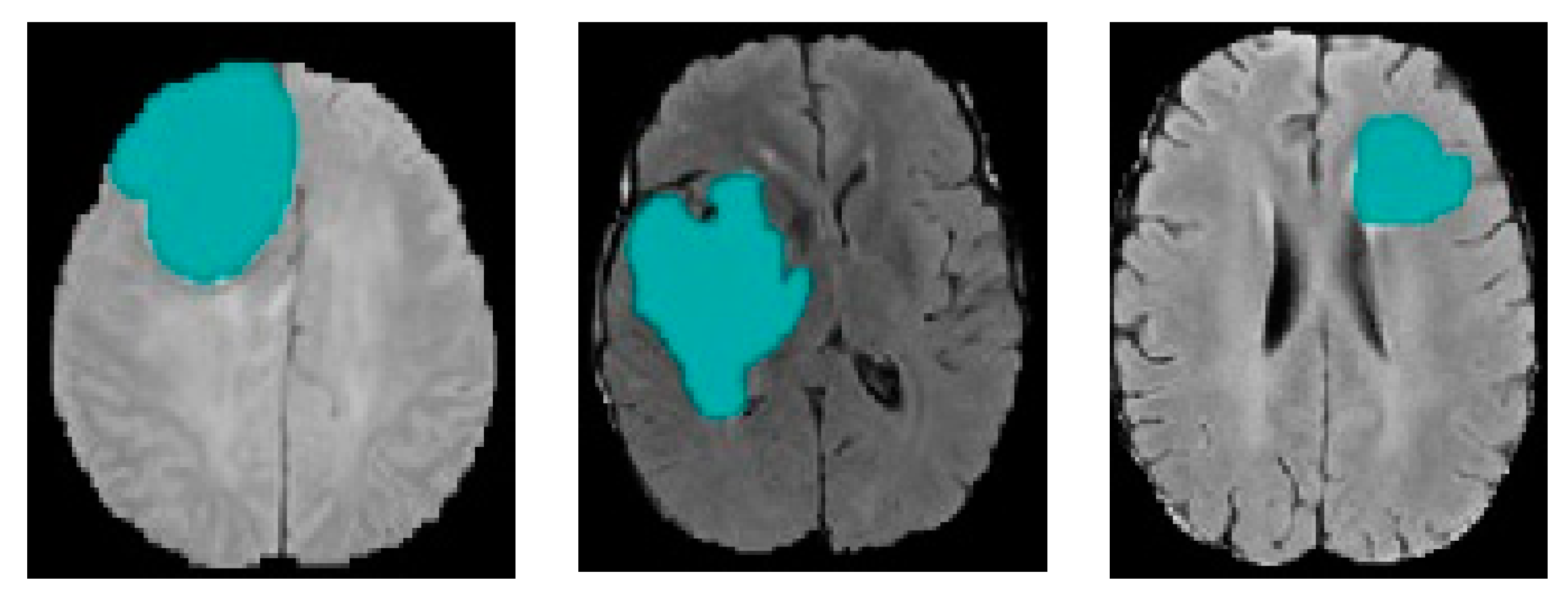 Bioengineering 10 00819 g018b