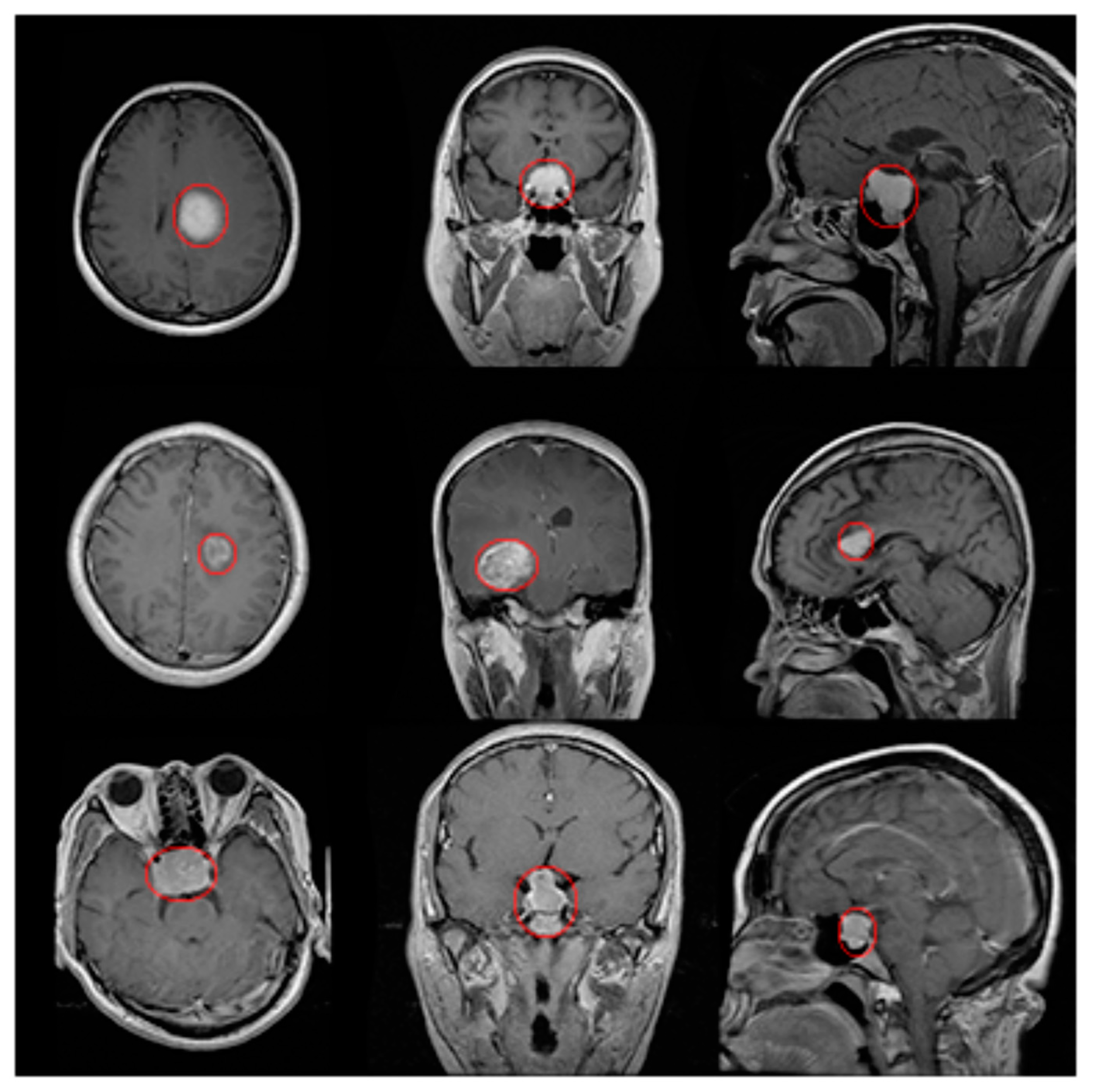 Bioengineering 10 00819 g020