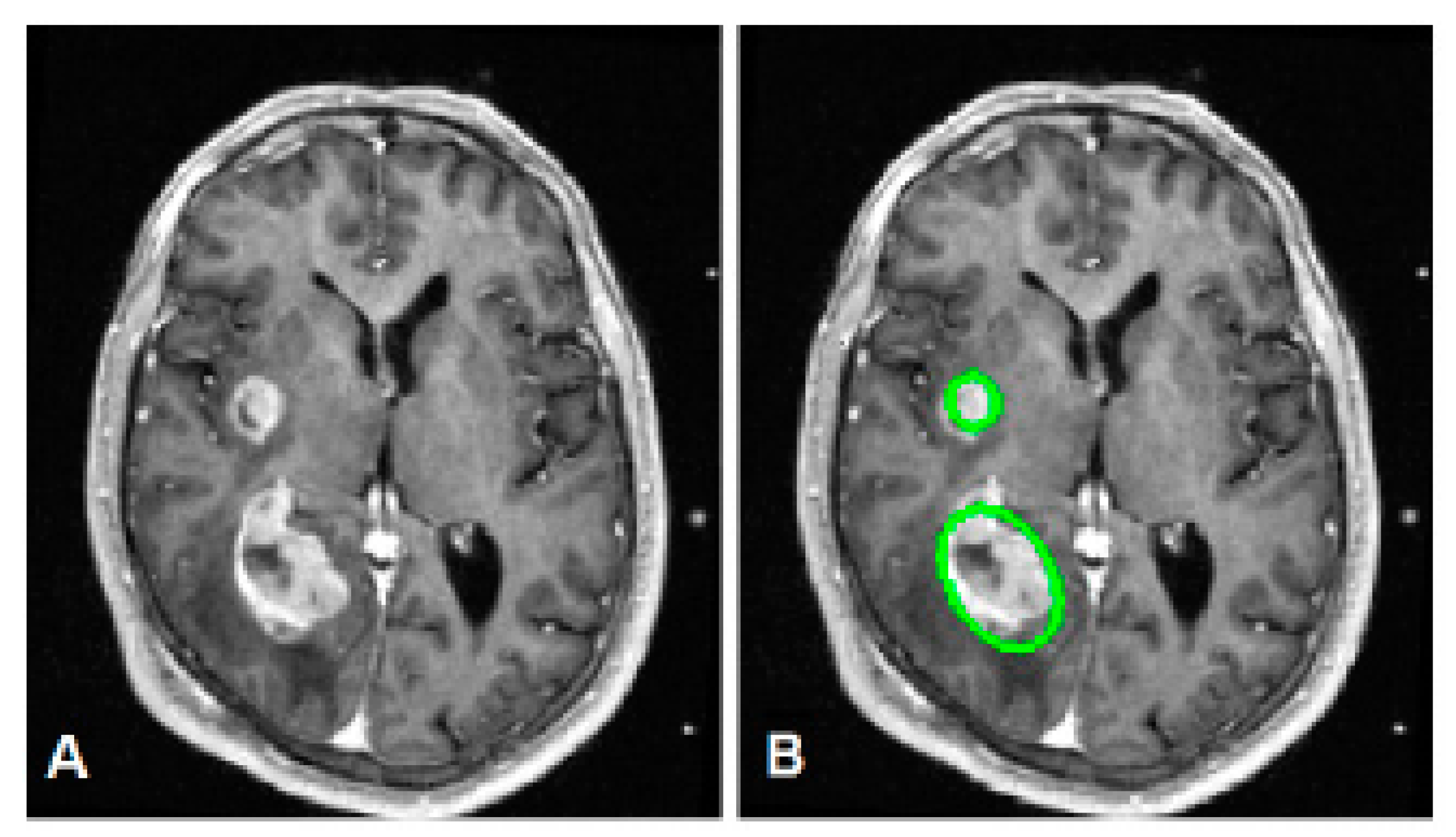 Bioengineering 10 00819 g021