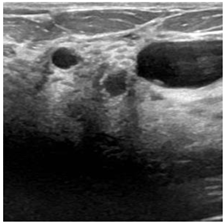 Bioengineering 10 00825 i001