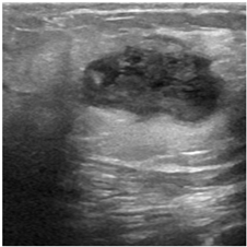 Bioengineering 10 00825 i002