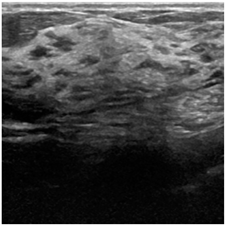 Bioengineering 10 00825 i003