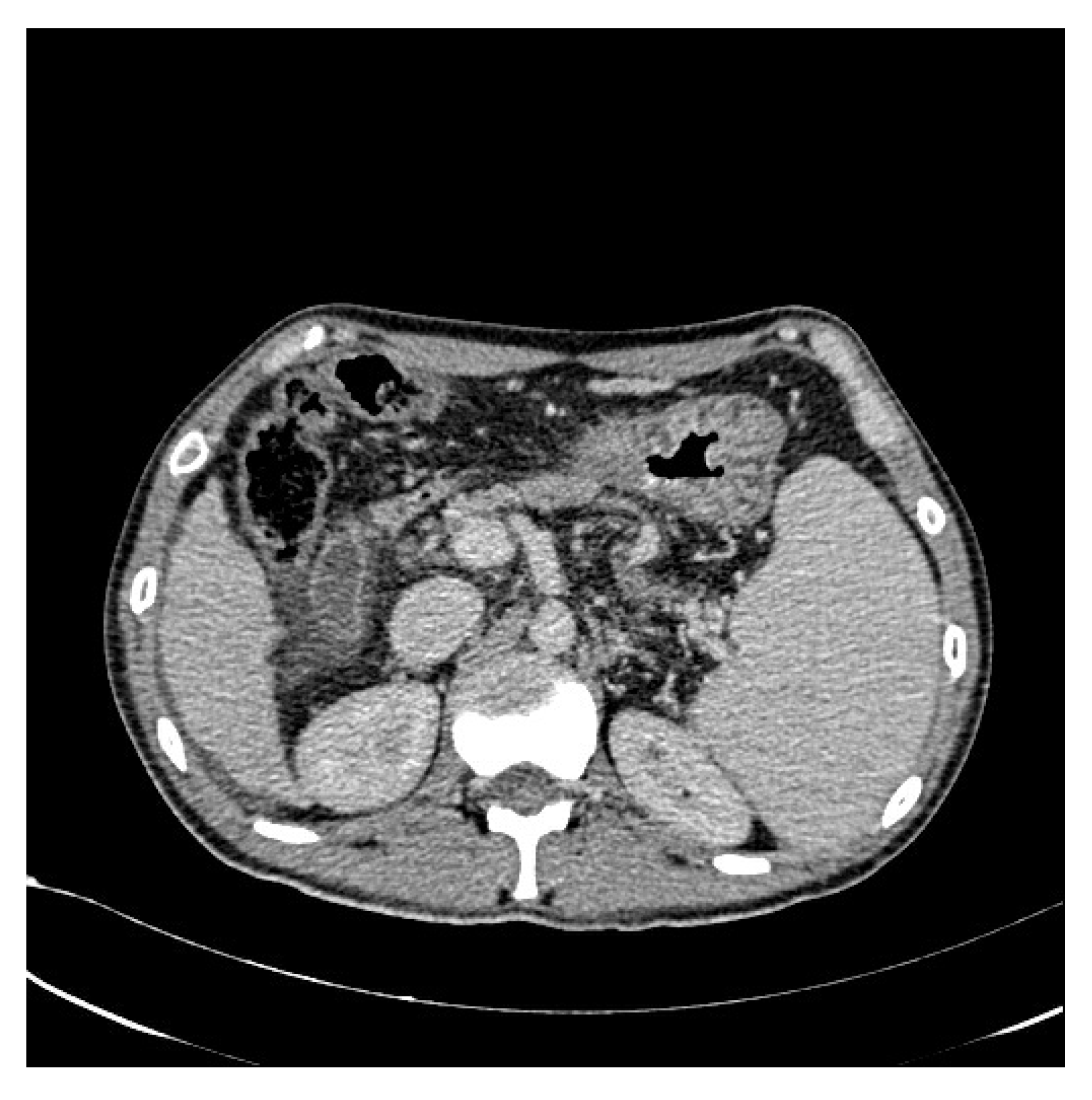 Bioengineering 10 00828 g003