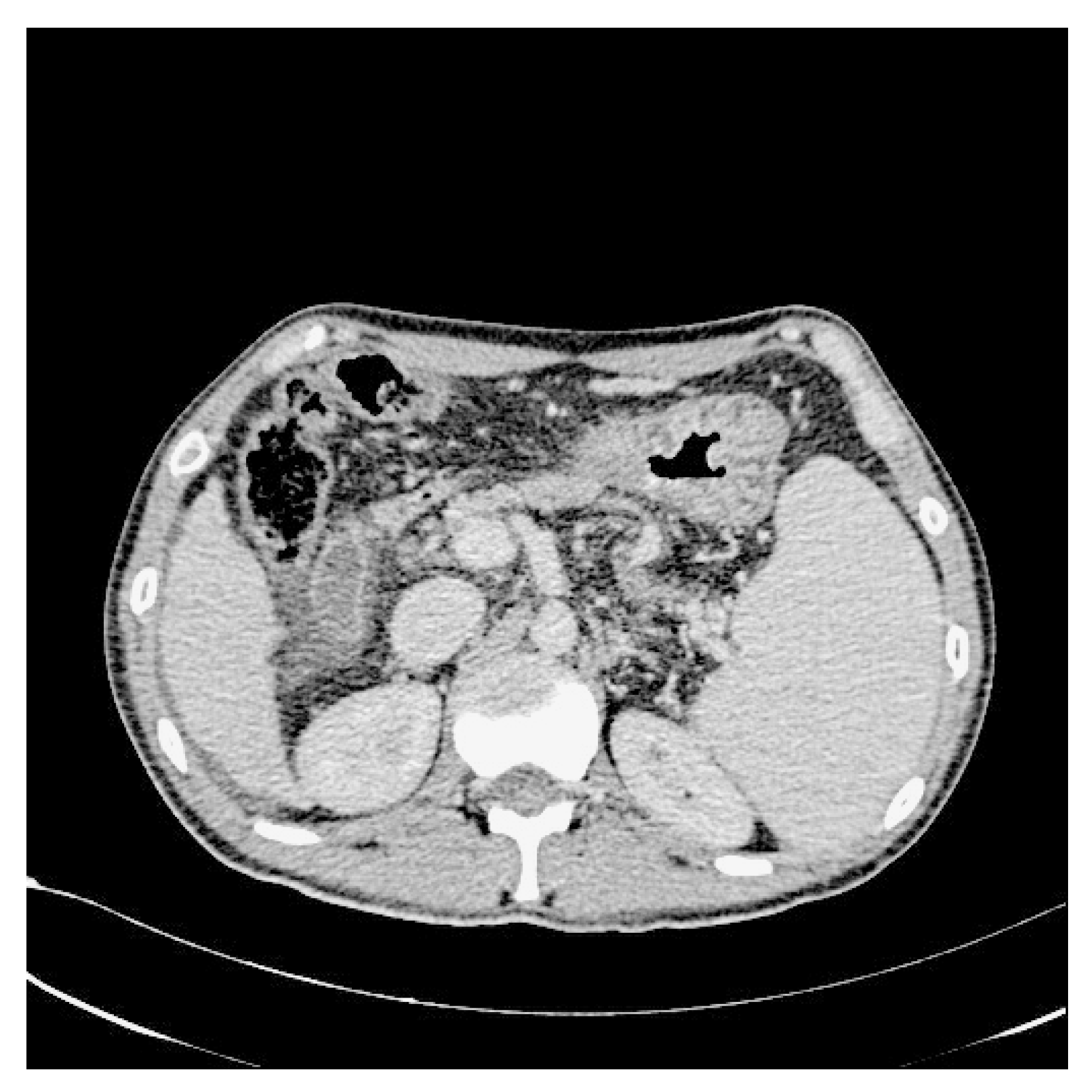 Bioengineering 10 00828 g004
