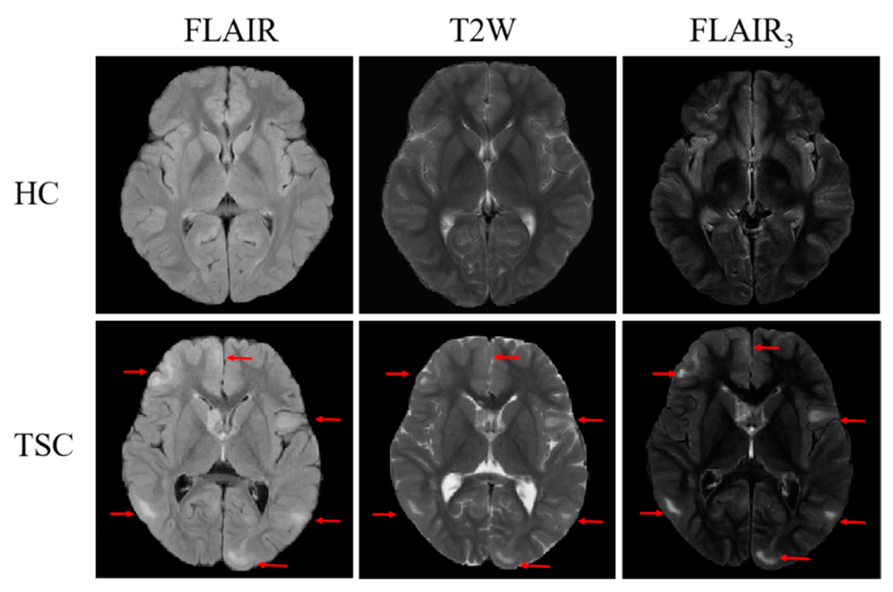 Bioengineering 10 00870 g004