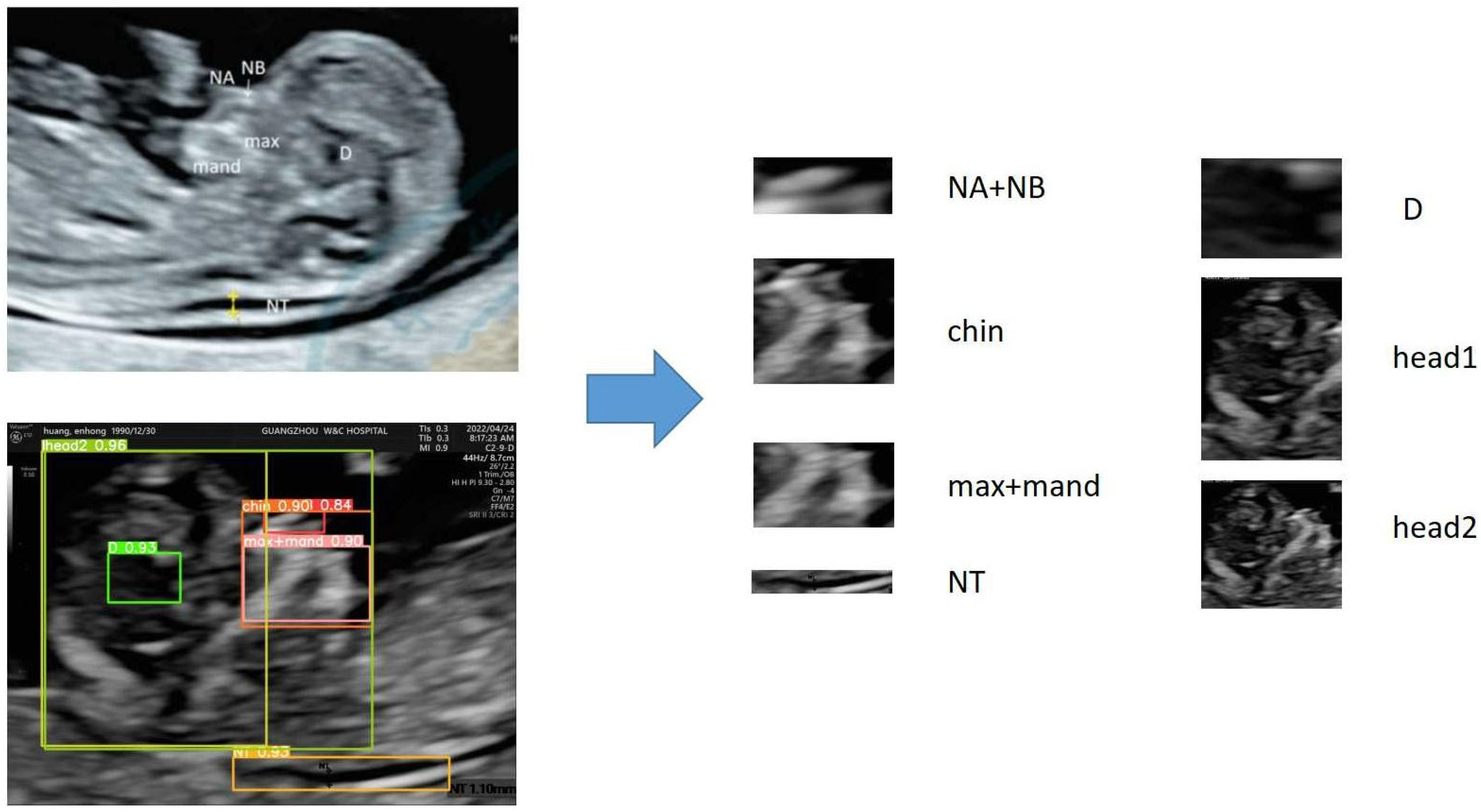 Bioengineering 10 00873 g001
