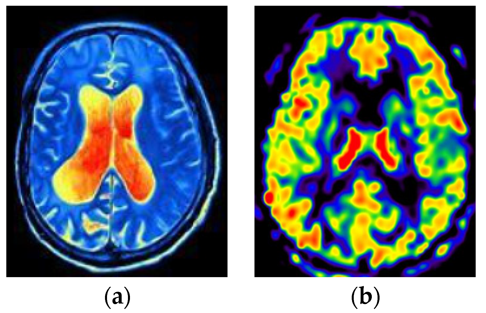 Bioengineering 10 00958 g005