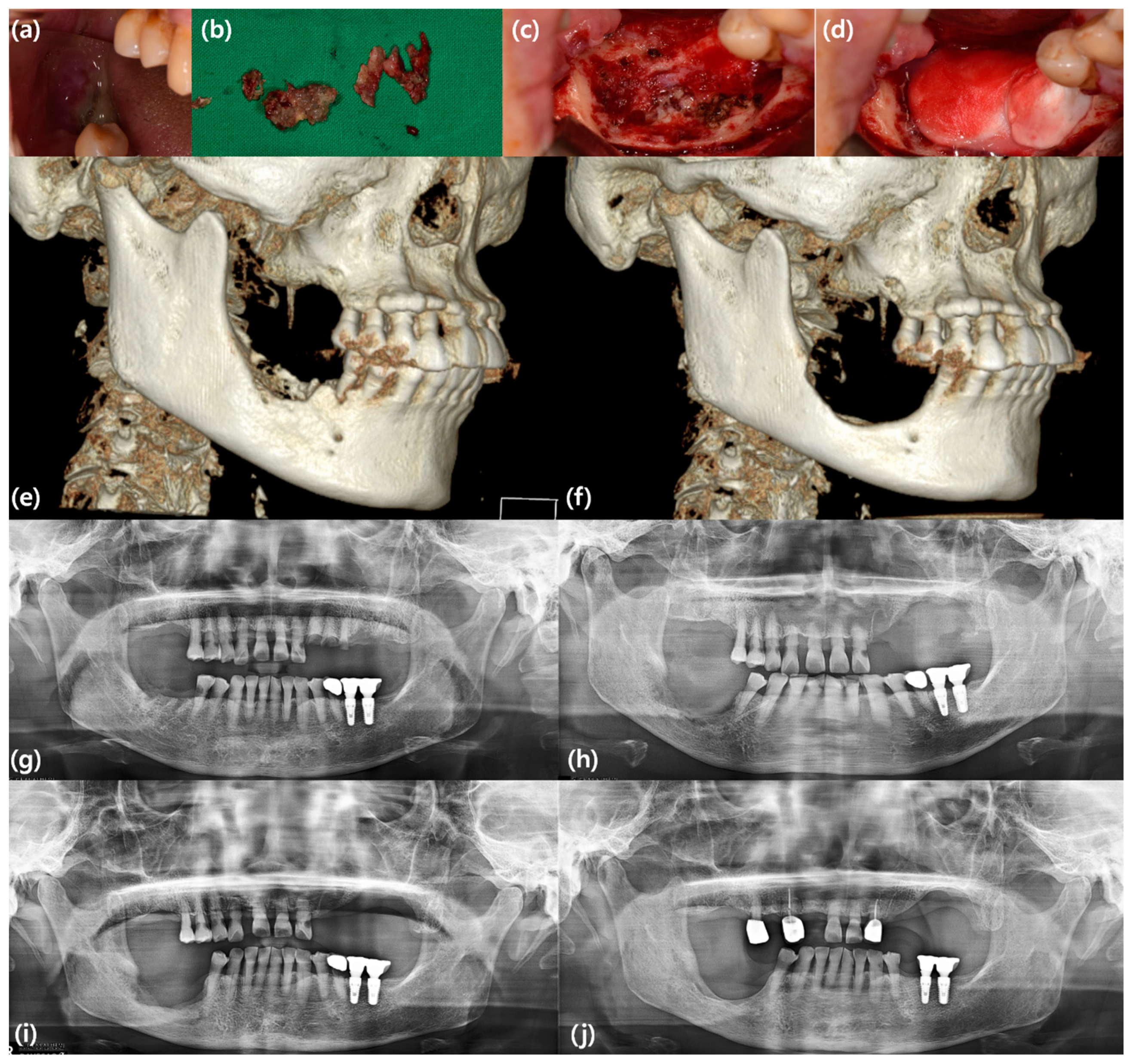 Bioengineering 10 01005 g002