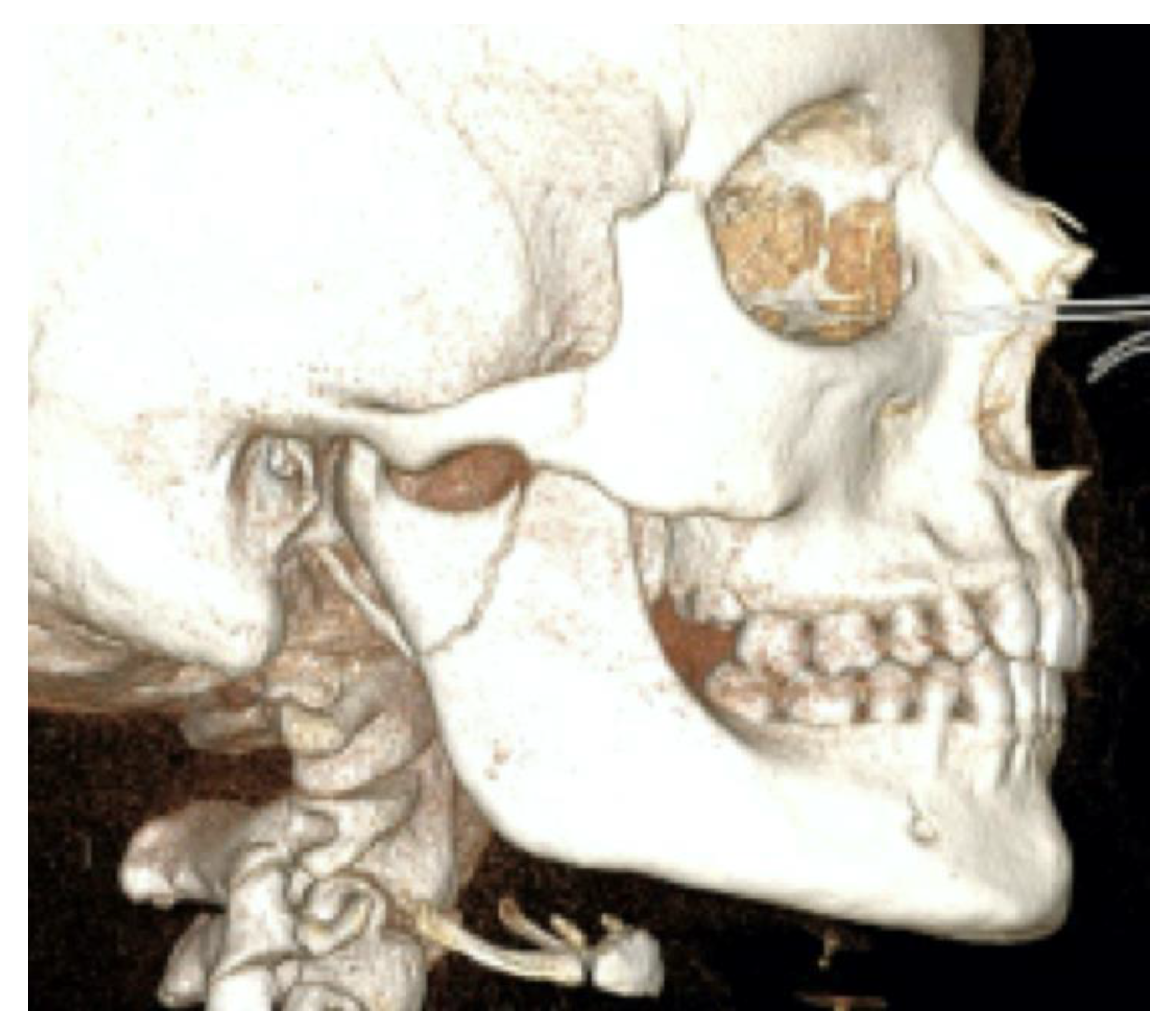 Bioengineering 10 01023 g003