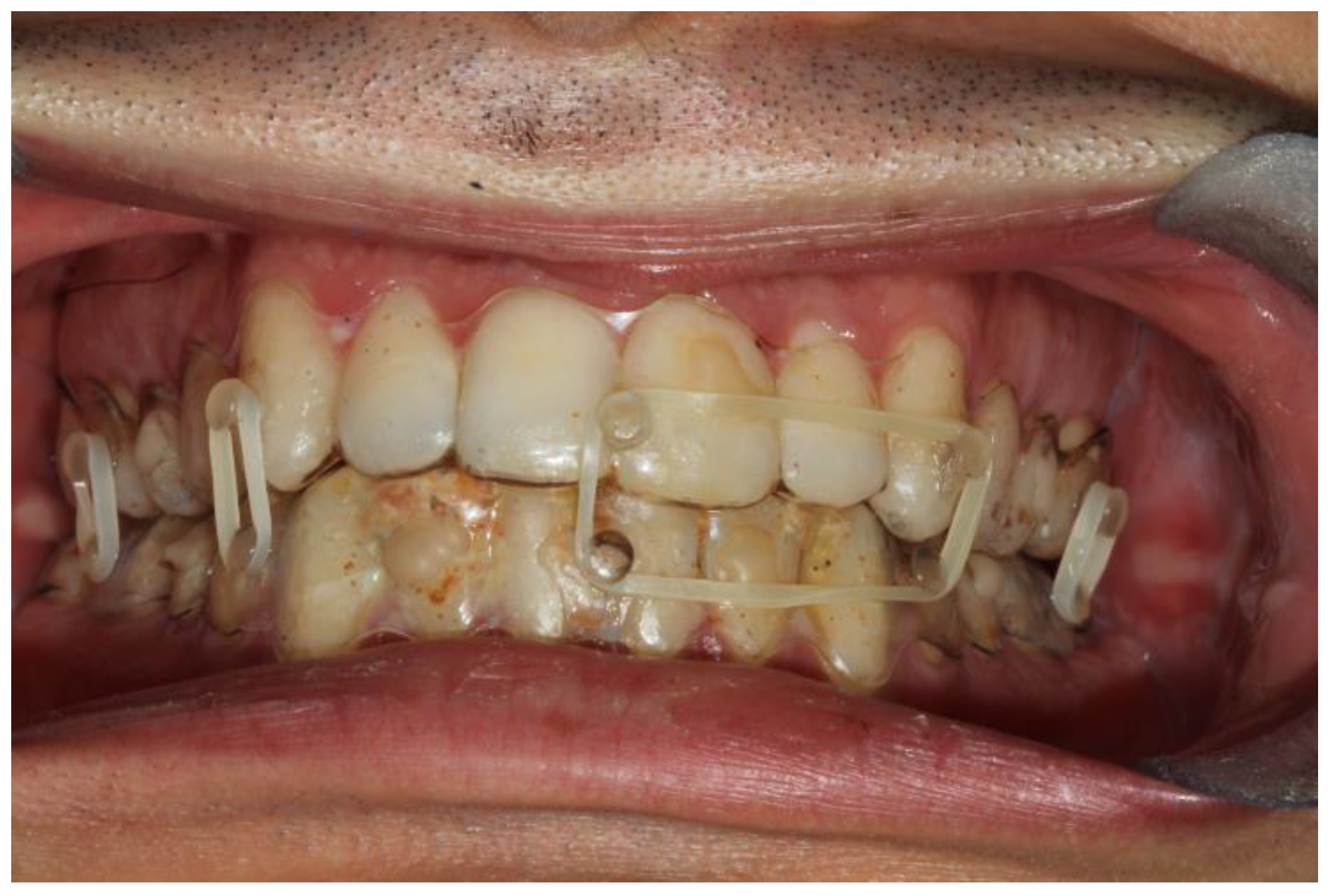 Bioengineering 10 01023 g005