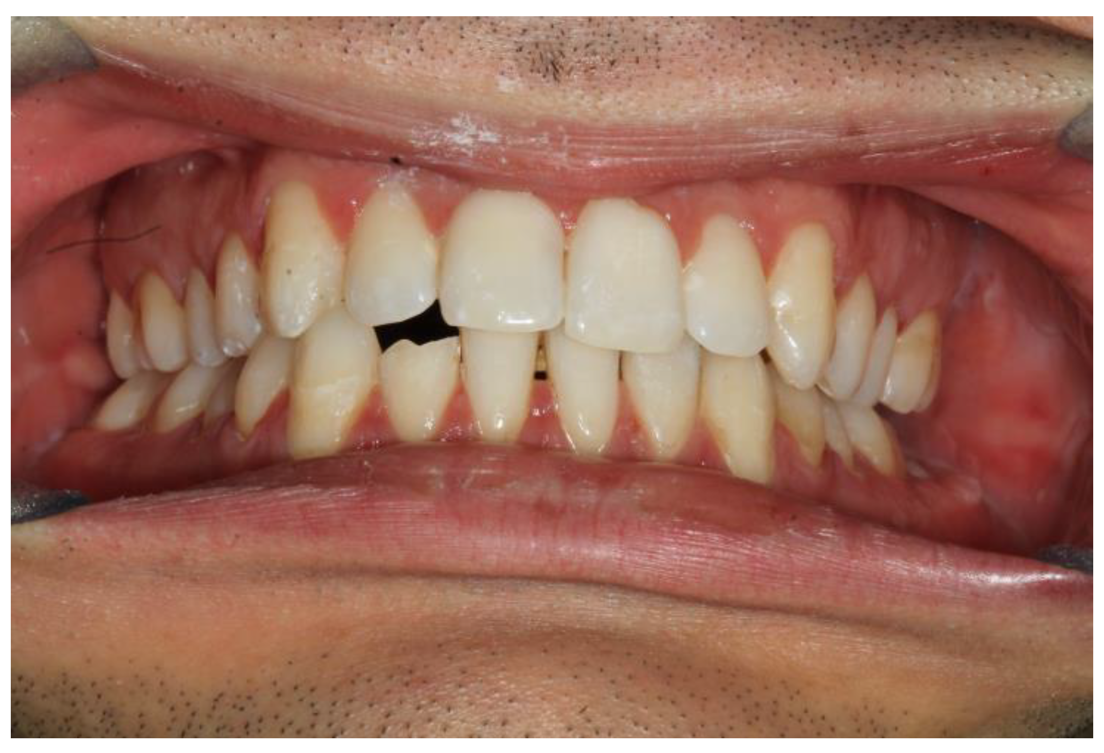 Bioengineering 10 01023 g007