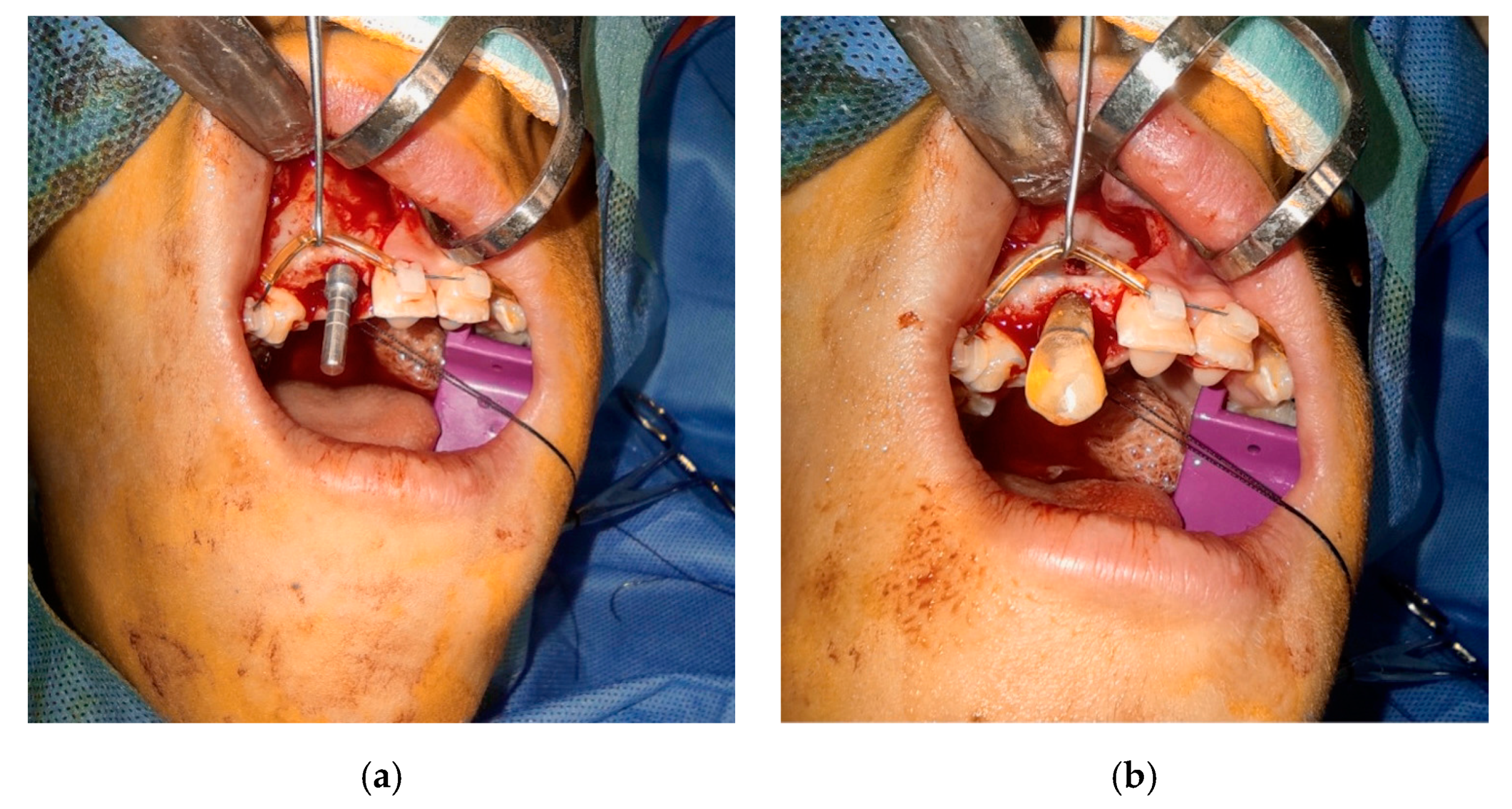 Bioengineering 10 01058 g005